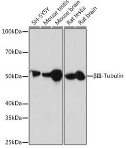 Western blot - ßIII-Tubulin antibody (A17913)