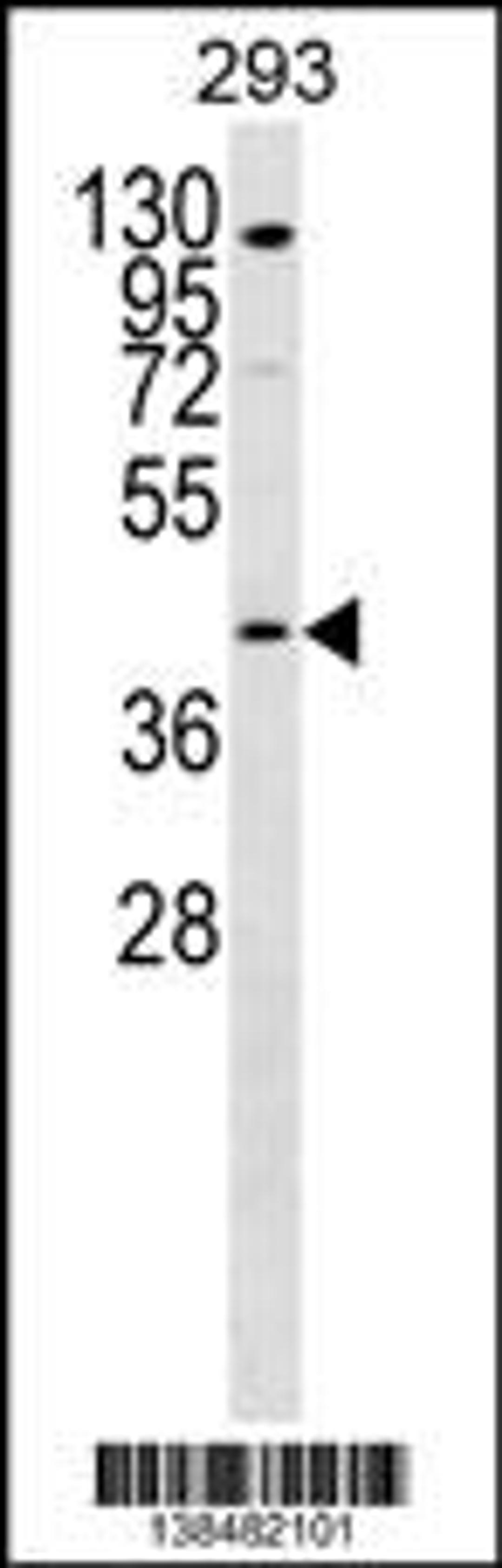 Western blot analysis in 293 cell line lysates (35ug/lane).