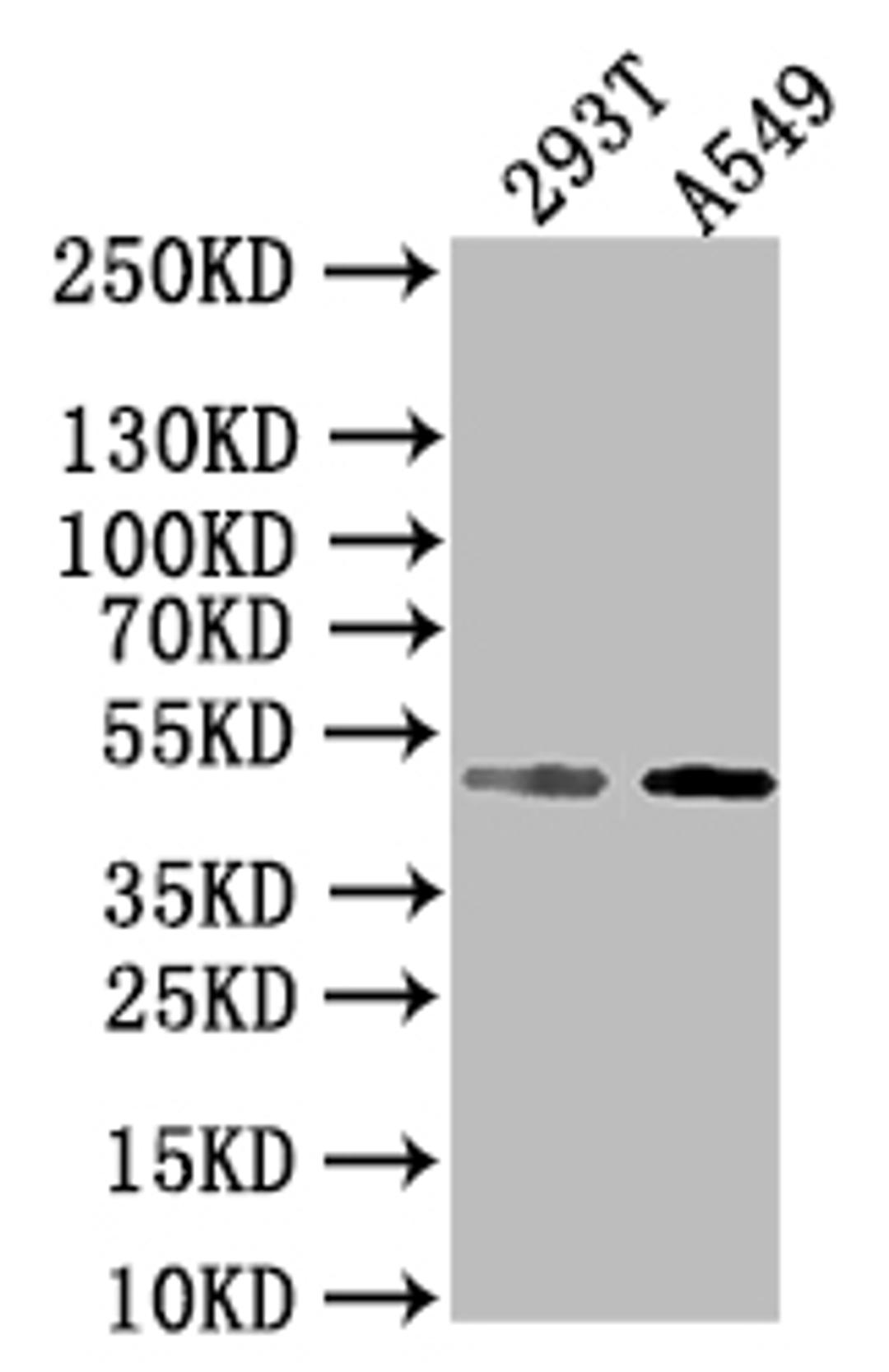 Western blot. All lanes: E2F2 antibody at 2µg/ml + 293T whole cell lysate. Secondary. Goat polyclonal to rabbit IgG at 1/10000 dilution. Predicted band size: 48 kDa. Observed band size: 48 kDa