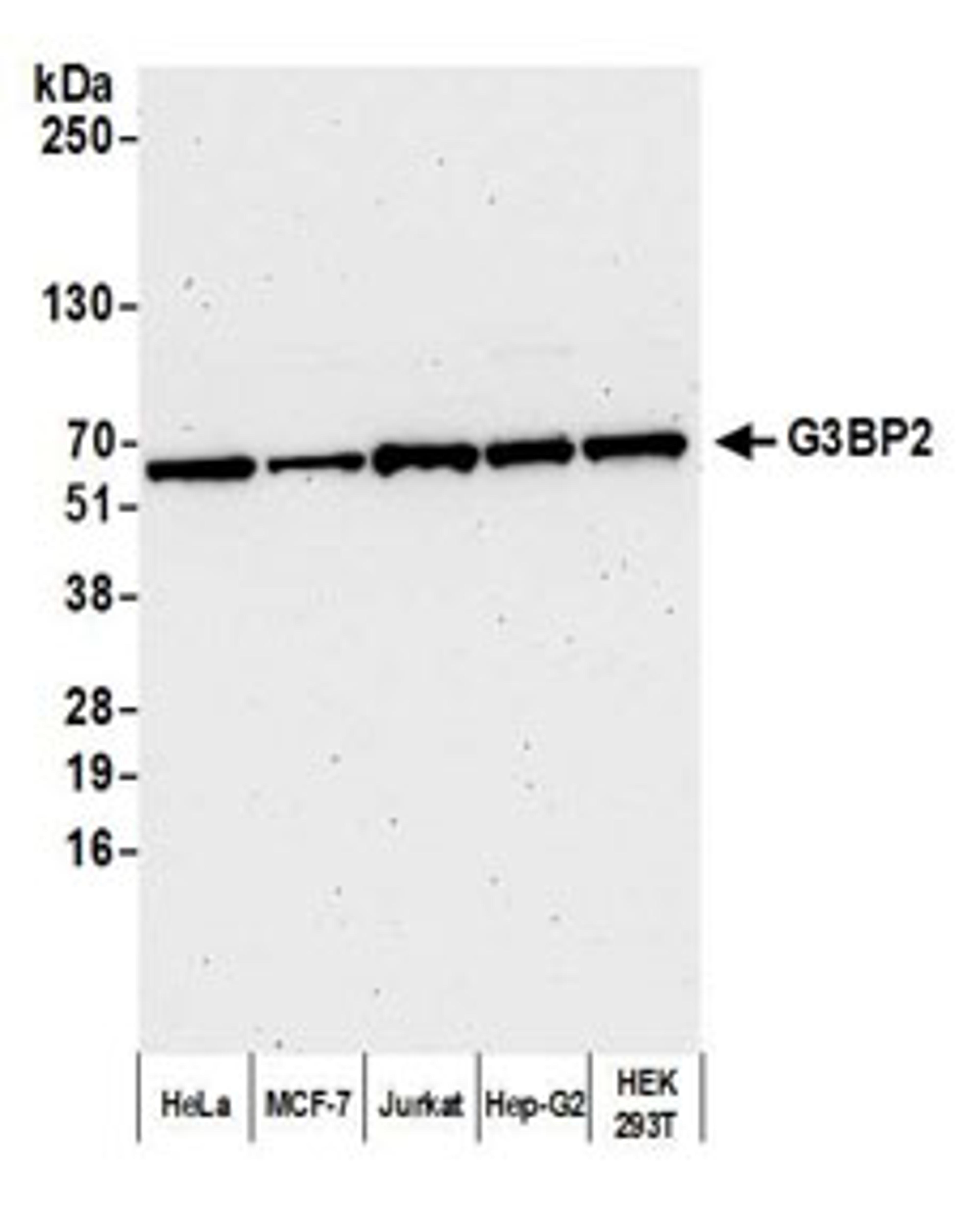 Detection of human G3BP2 by western blot.