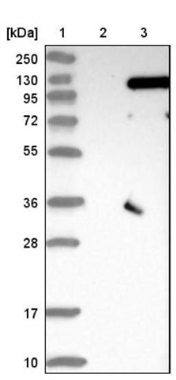 Western Blot: SRPK2 Antibody [NBP1-87049] - Lane 1: Marker [kDa] 250, 130, 95, 72, 55, 36, 28, 17, 10<br/>Lane 2: Negative control (vector only transfected HEK293T lysate)<br/>Lane 3: Over-expression lysate (Co-expressed with a C-terminal myc-DDK tag (~3.1 kDa) in mammalian HEK293T cells, LY403641)