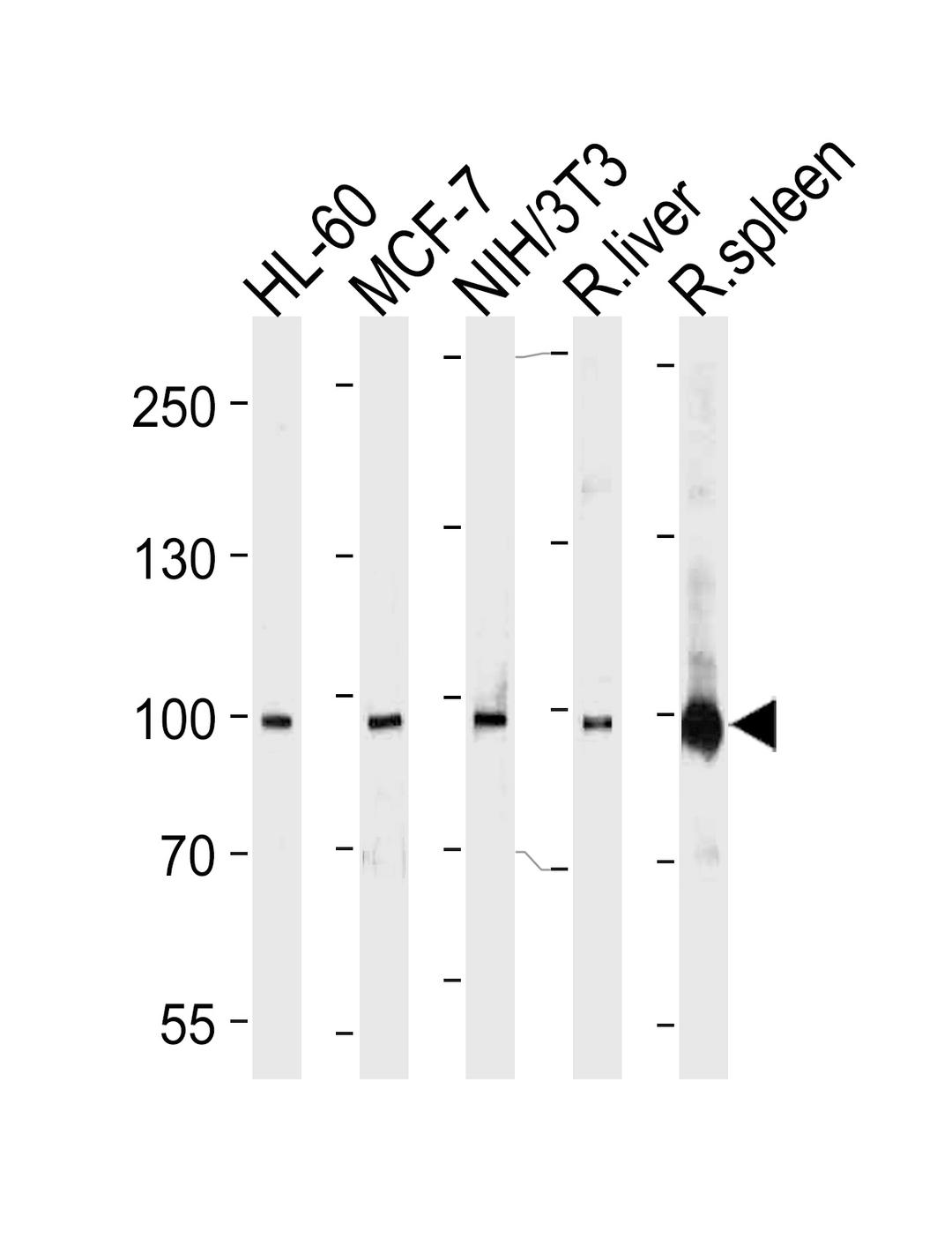 Western blot analysis in HL-60,MCF-7,mouse NIH/3T3 cell line, rat liver and spleen lysates (35ug/lane).