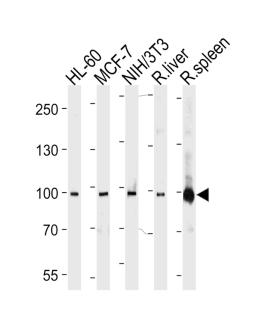 Western blot analysis in HL-60,MCF-7,mouse NIH/3T3 cell line, rat liver and spleen lysates (35ug/lane).