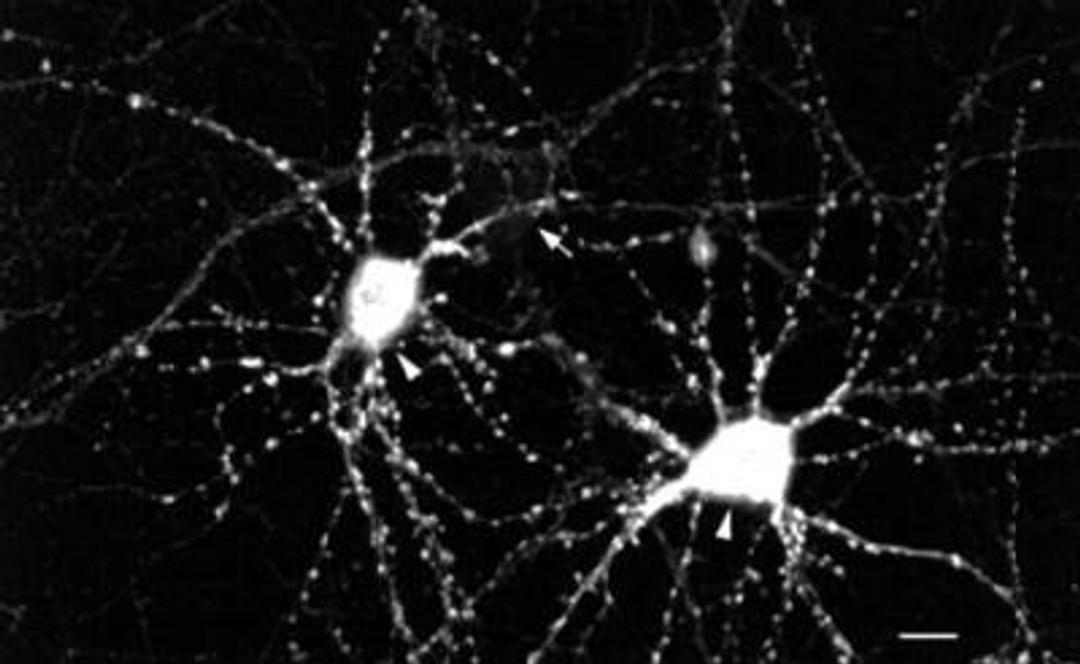 Immunohistochemistry: CaMKII alpha/beta [p Thr286, p Thr287] Antibody (22B1) [NB110-96869] - Immunohistochemical detection of CamKII using NB110-96869 in hippocampal neurons.