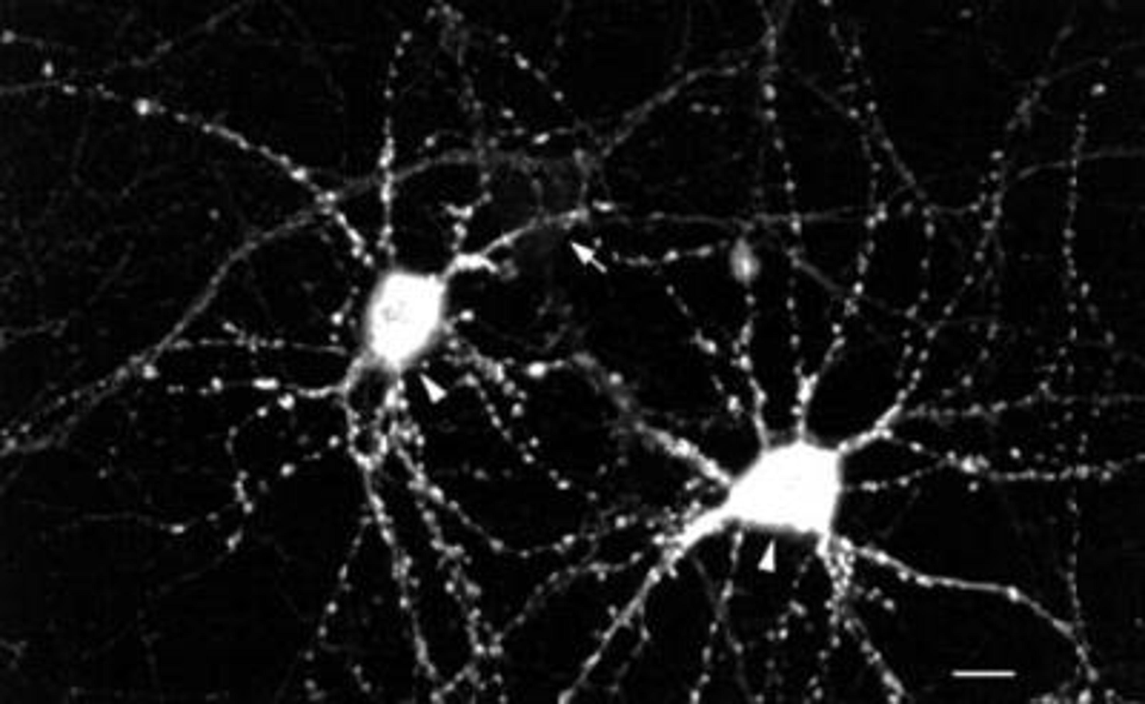 Immunohistochemistry: CaMKII alpha/beta [p Thr286, p Thr287] Antibody (22B1) [NB110-96869] - Immunohistochemical detection of CamKII using NB110-96869 in hippocampal neurons.