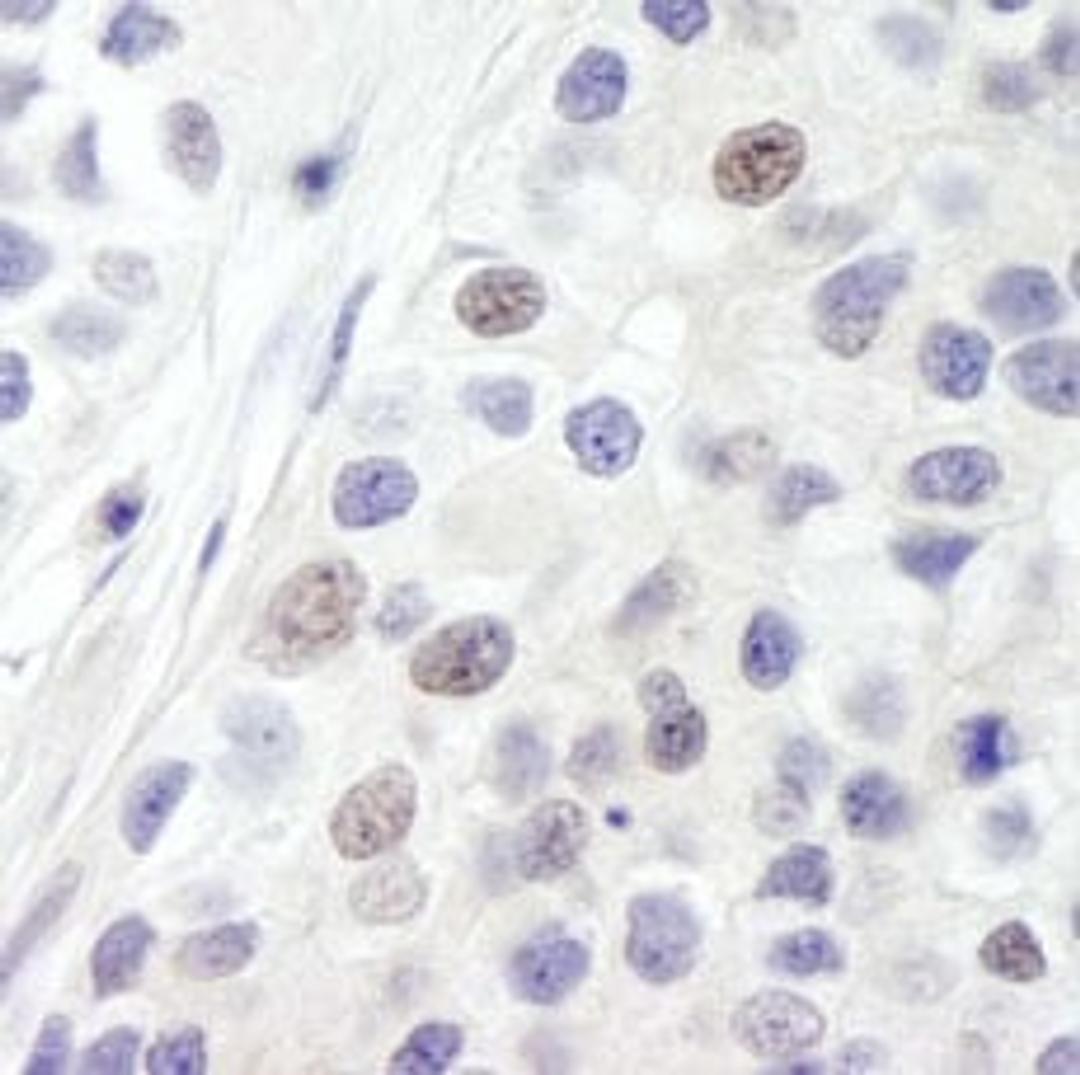 Detection of human INT8 by immunohistochemistry.