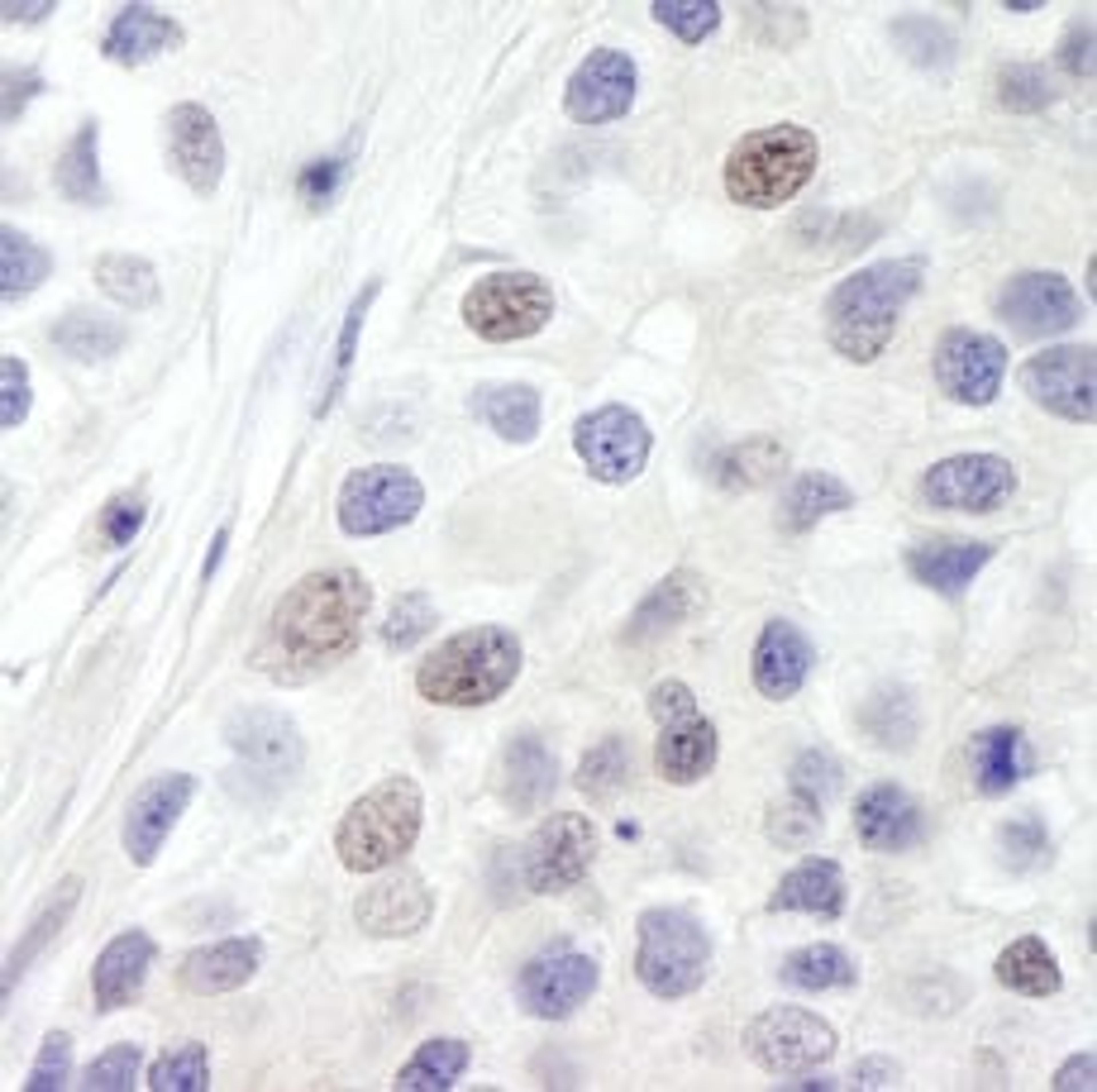 Detection of human INT8 by immunohistochemistry.