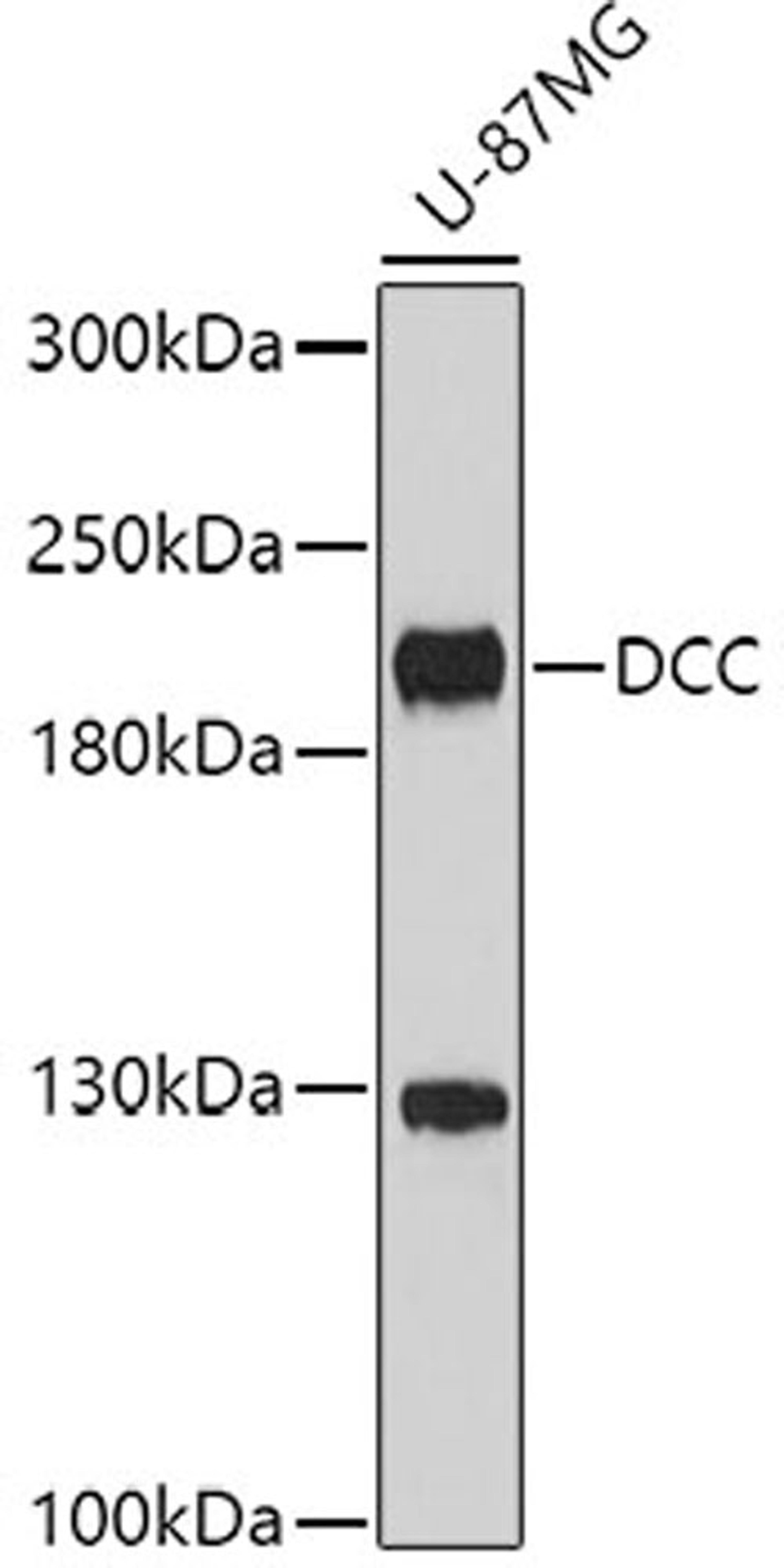 Western blot - DCC antibody (A9372)