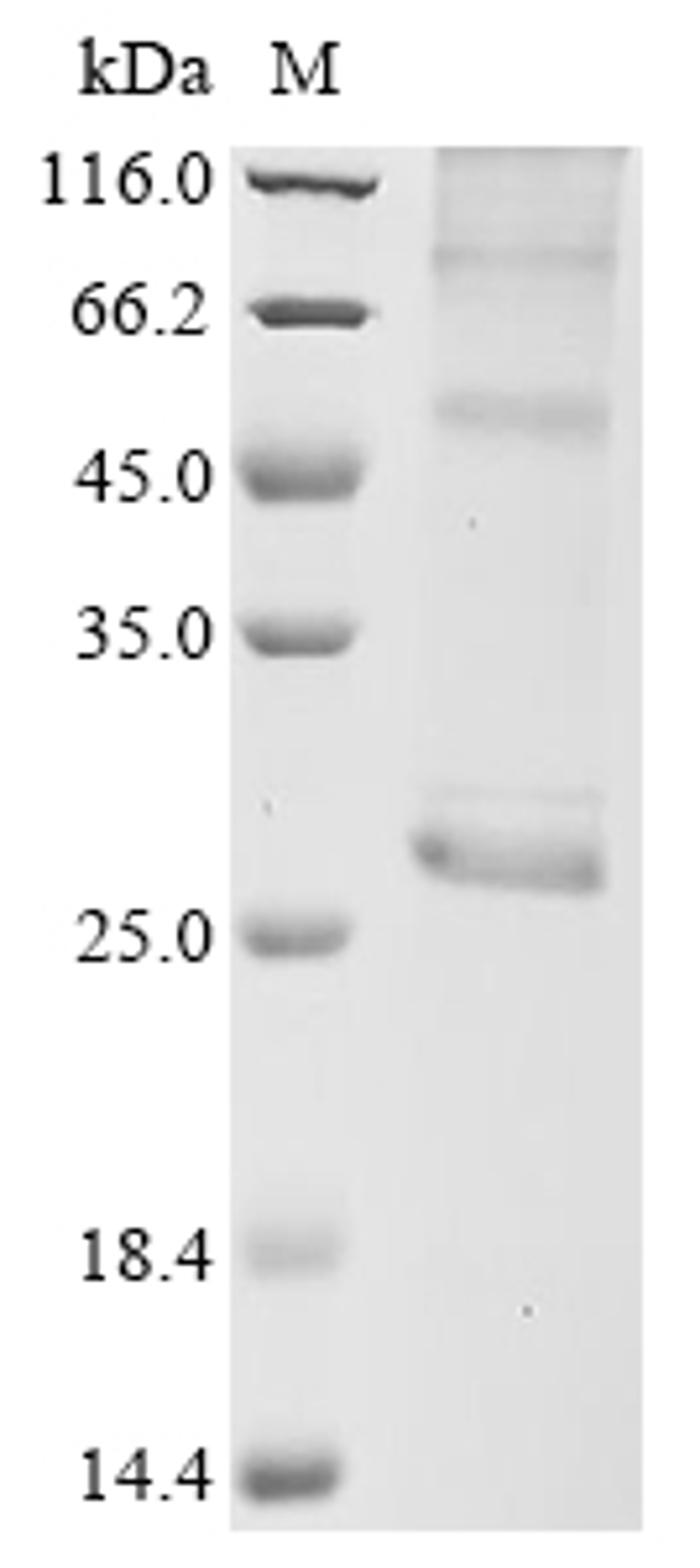 (Tris-Glycine gel) Discontinuous SDS-PAGE (reduced) with 5% enrichment gel and 15% separation gel.