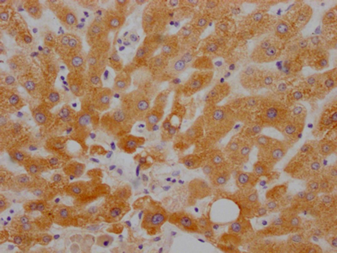 IHC image of CSB-RA784971A0HU diluted at 1:100 and staining in paraffin-embedded human liver tissue performed on a Leica BondTM system. After dewaxing and hydration, antigen retrieval was mediated by high pressure in a citrate buffer (pH 6.0). Section was blocked with 10% normal goat serum 30min at RT. Then primary antibody (1% BSA) was incubated at 4℃ overnight. The primary is detected by a Goat anti-rabbit IgG polymer labeled by HRP and visualized using 0.05% DAB.
