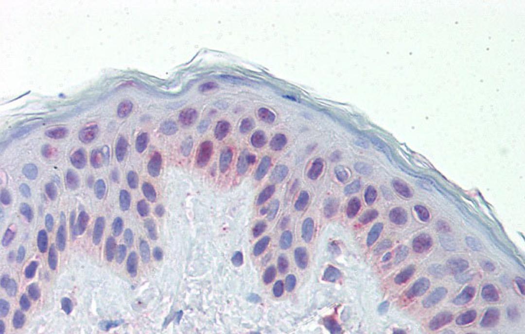 Antibody used in IHC on Human Skin at 5.0 ug/ml.