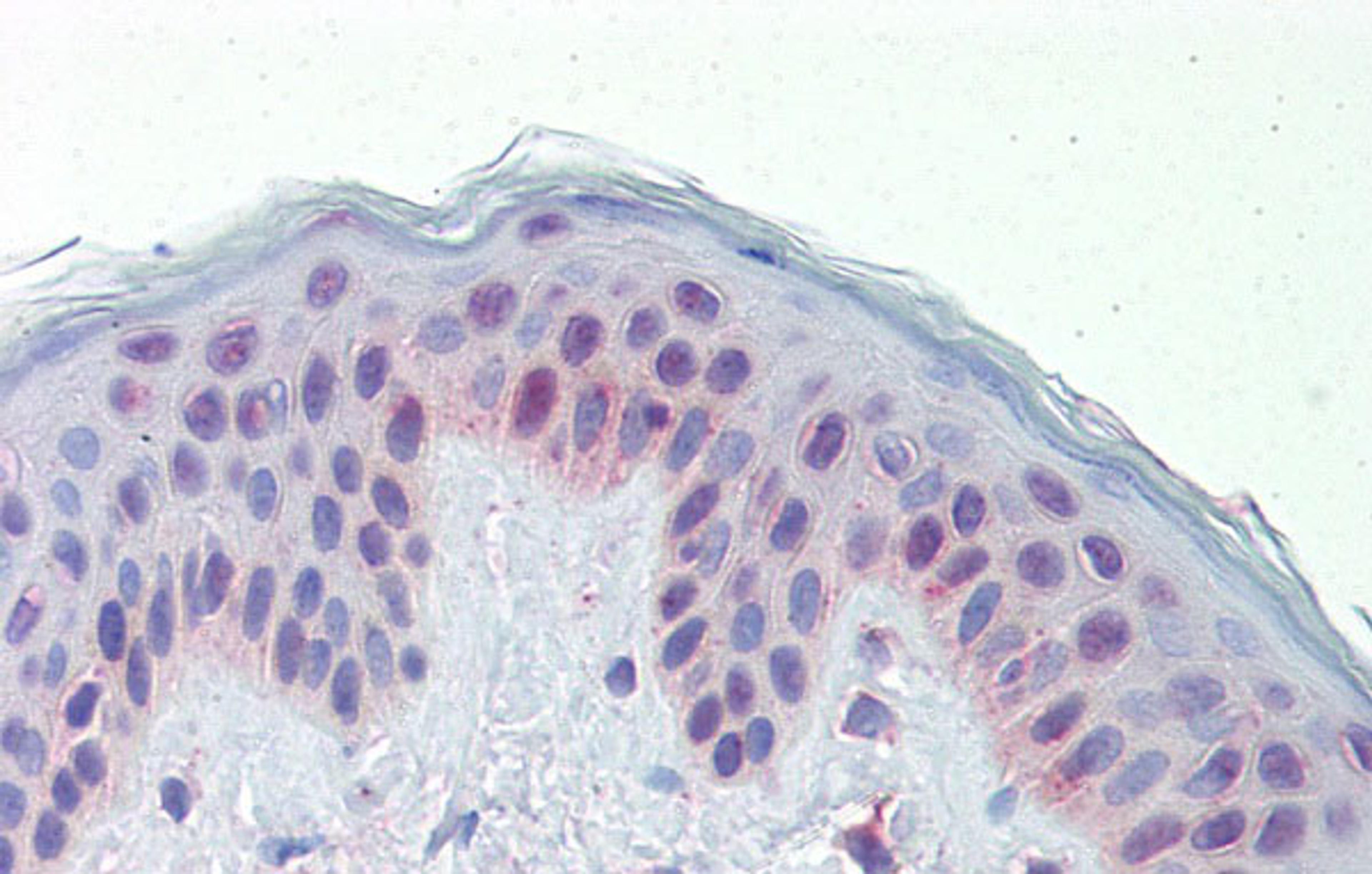 Antibody used in IHC on Human Skin at 5.0 ug/ml.