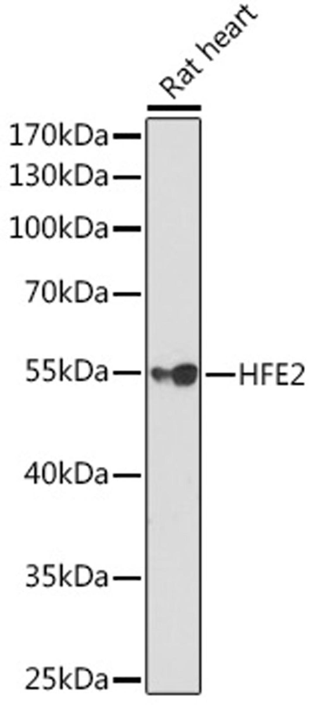 Western blot - HFE2 Rabbit pAb (A5348)