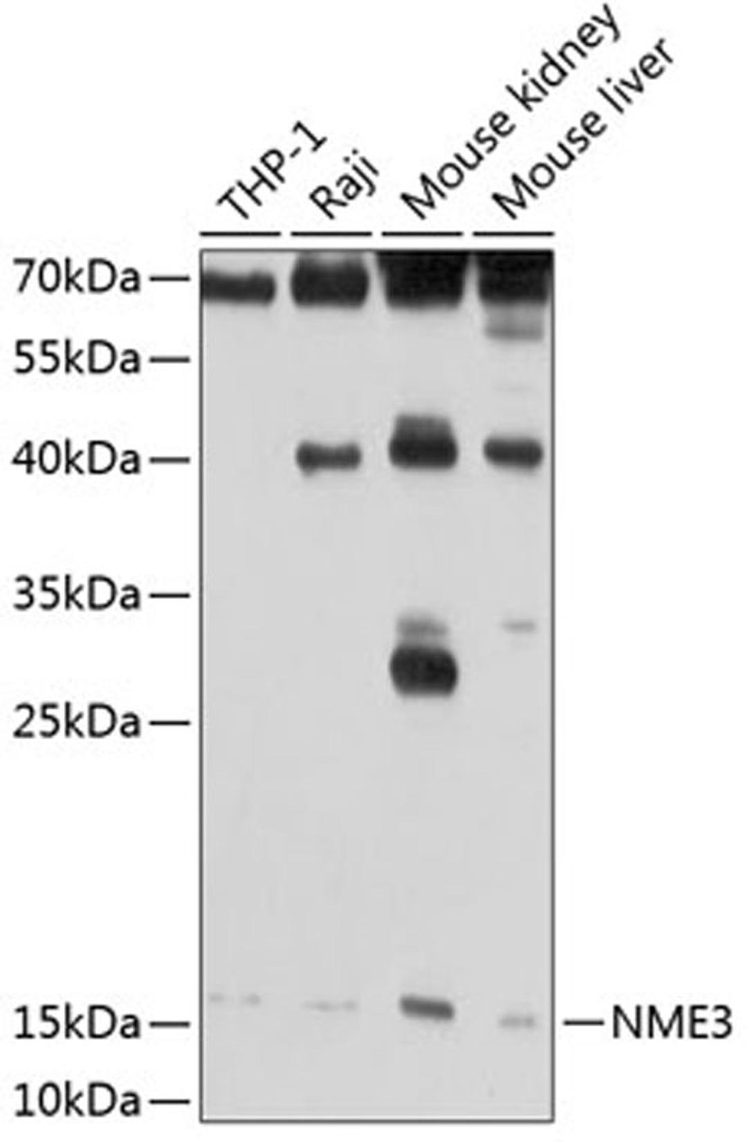 Western blot - NME3 antibody (A2774)