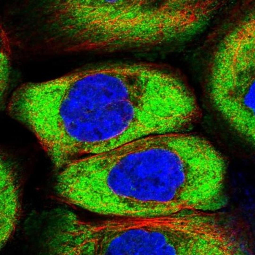 Immunocytochemistry/Immunofluorescence: PLA2G4C Antibody [NBP1-85480] - Immunofluorescent staining of human cell line A-431 shows positivity in cytoplasm.