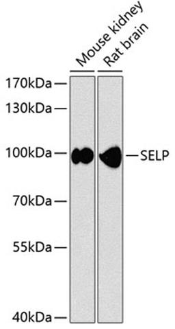 Western blot - SELP antibody (A12512)