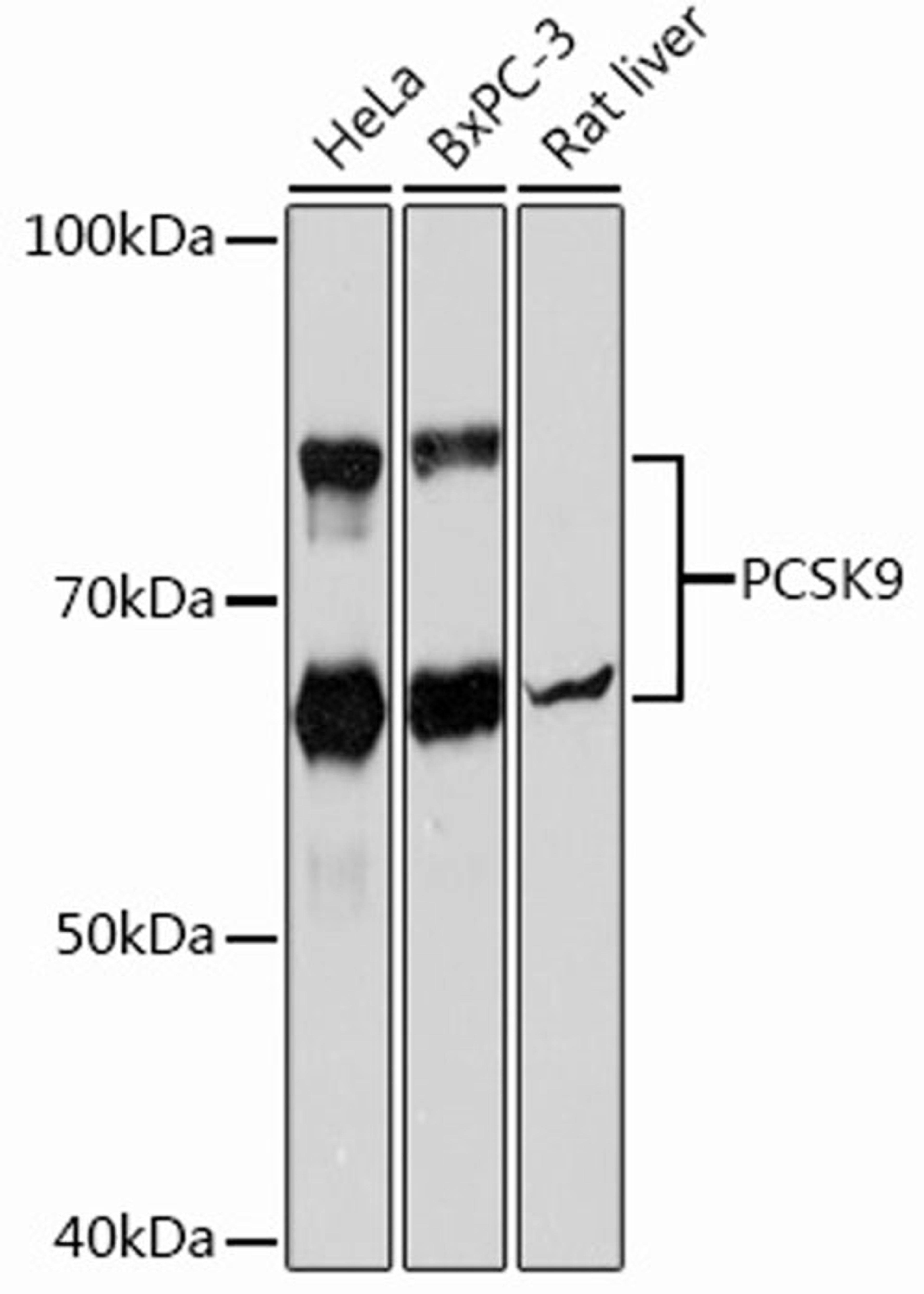 Western blot - PCSK9 Rabbit mAb (A11532)