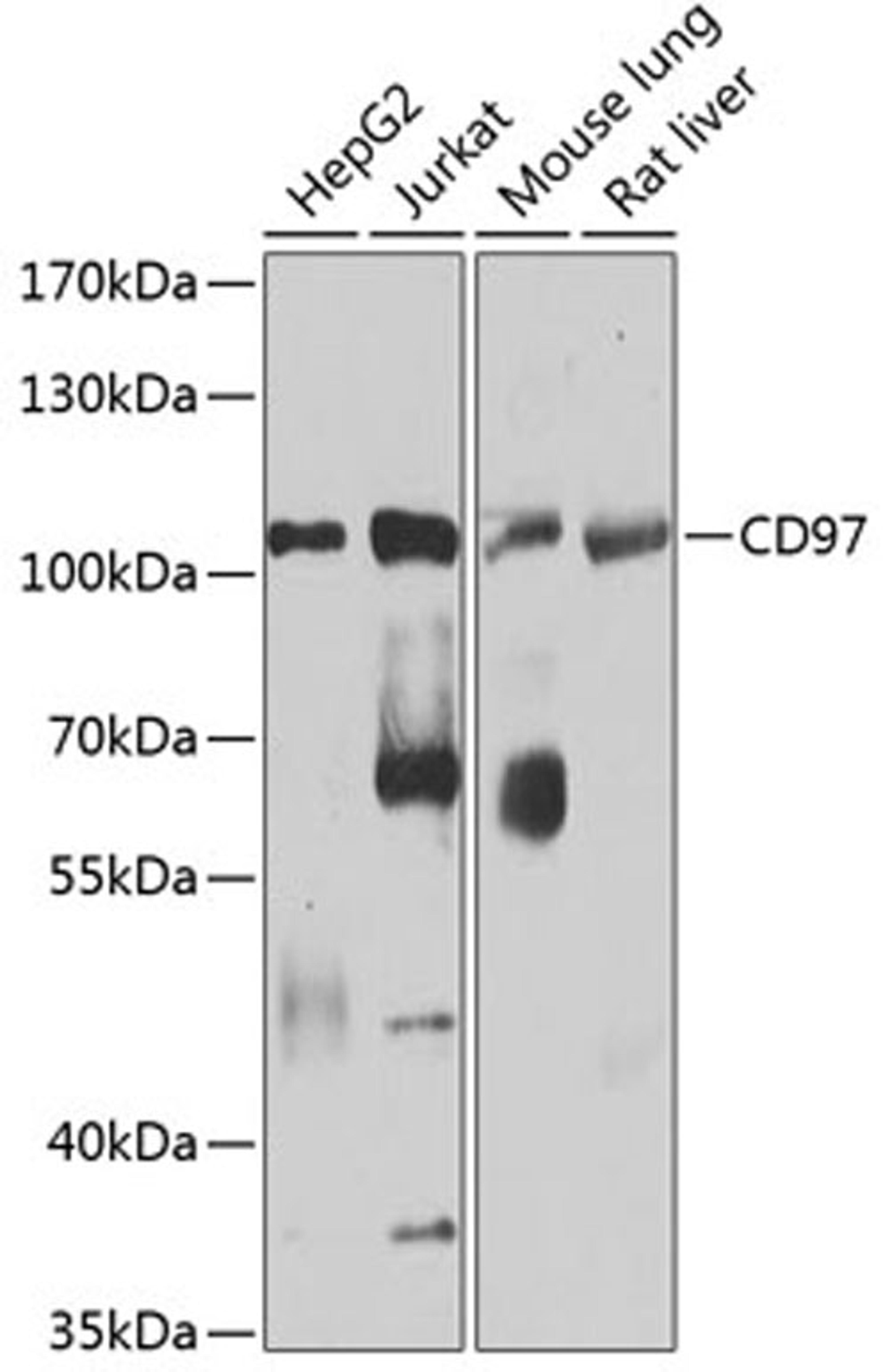 Western blot - CD97 antibody (A3780)