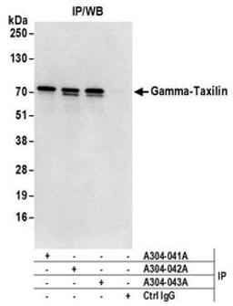 Detection of human Gamma-Taxilin by western blot of immunoprecipitates.