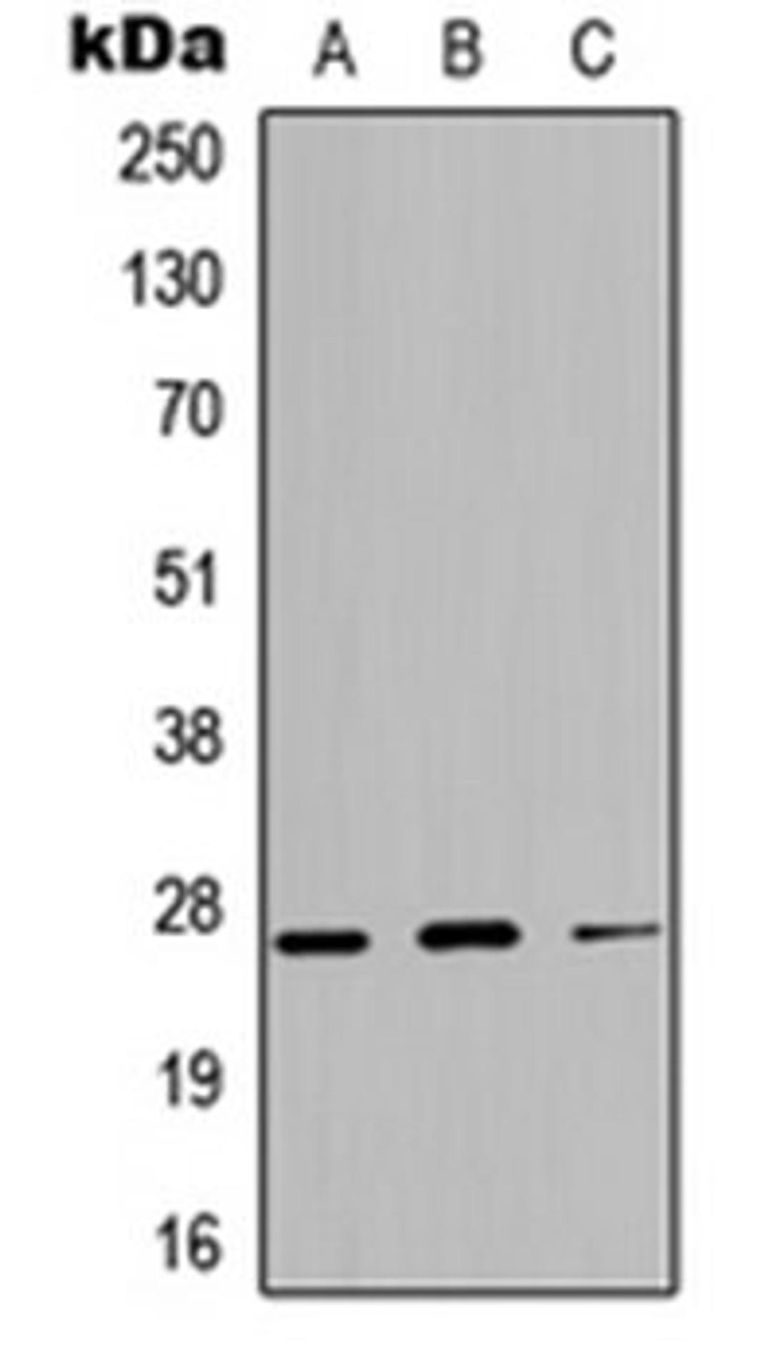 Western blot analysis of A549 (Lane 1), NS-1 (Lane 2), H9C2 (Lane 3) whole cell lysates using Kallikrein 4 antibody