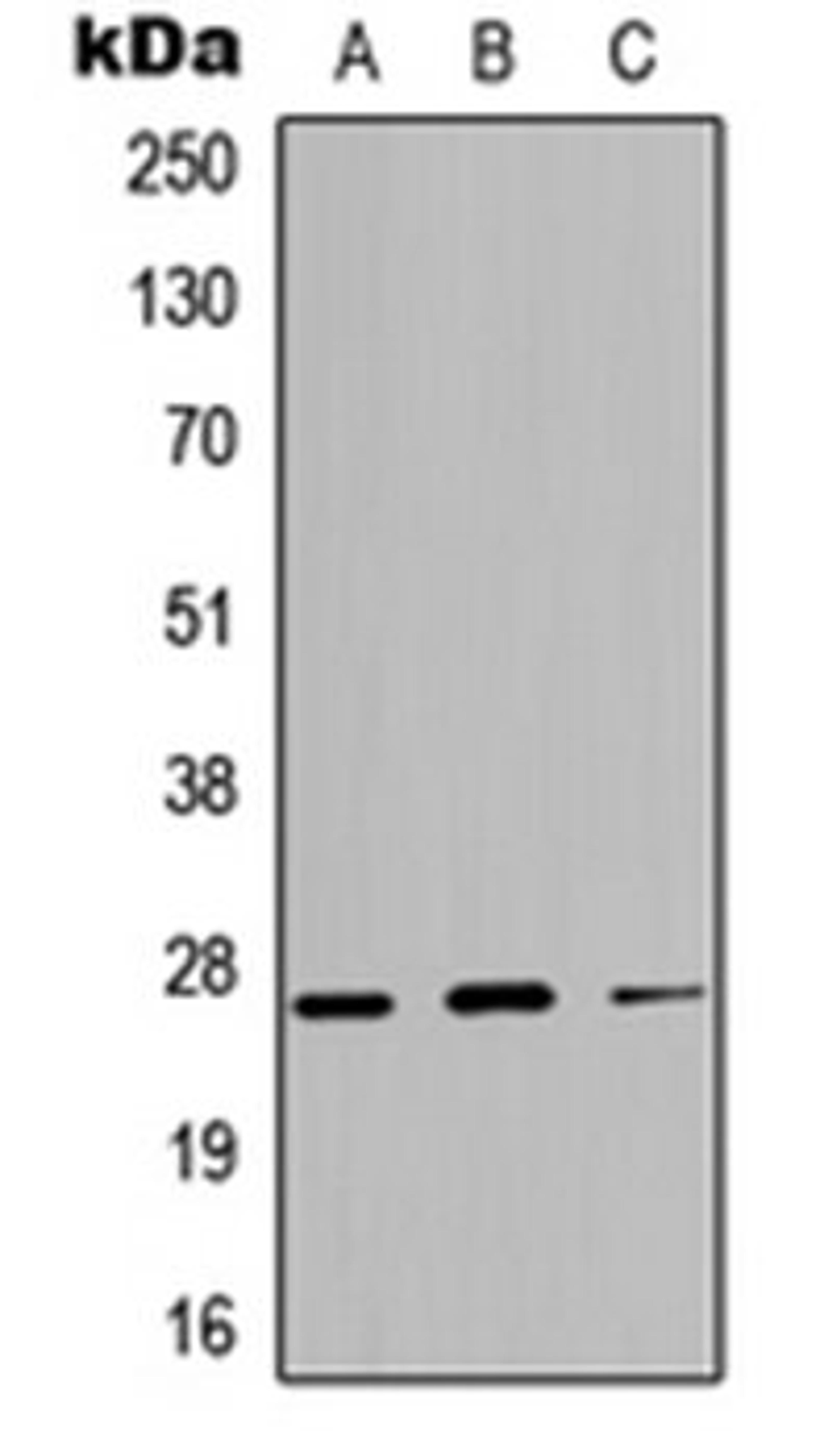 Western blot analysis of A549 (Lane 1), NS-1 (Lane 2), H9C2 (Lane 3) whole cell lysates using Kallikrein 4 antibody