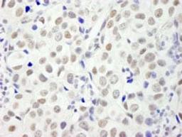 Detection of human DFF45/DFFA by immunohistochemistry.