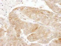 Detection of human TSC22D1 by immunohistochemistry.