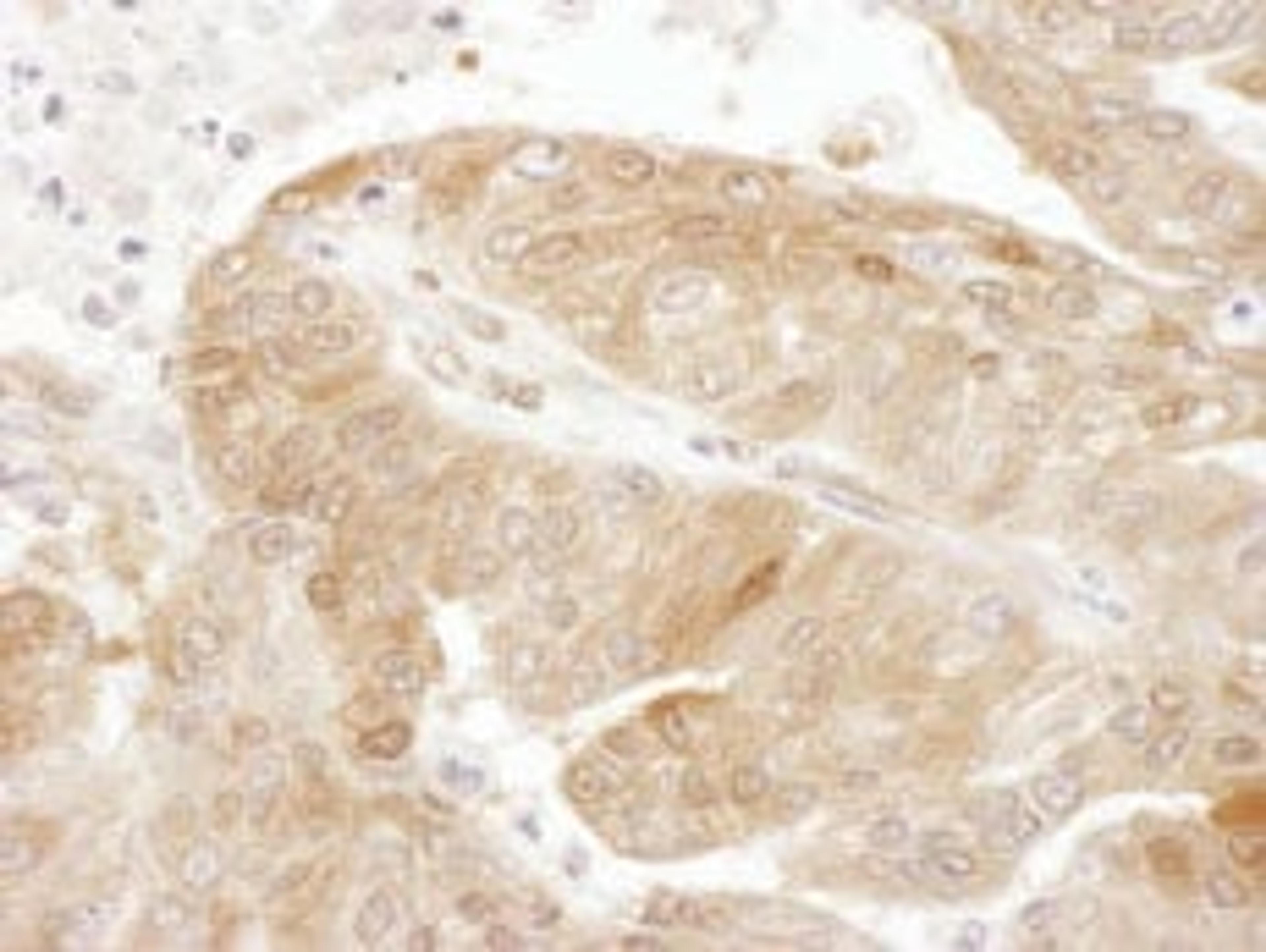 Detection of human TSC22D1 by immunohistochemistry.