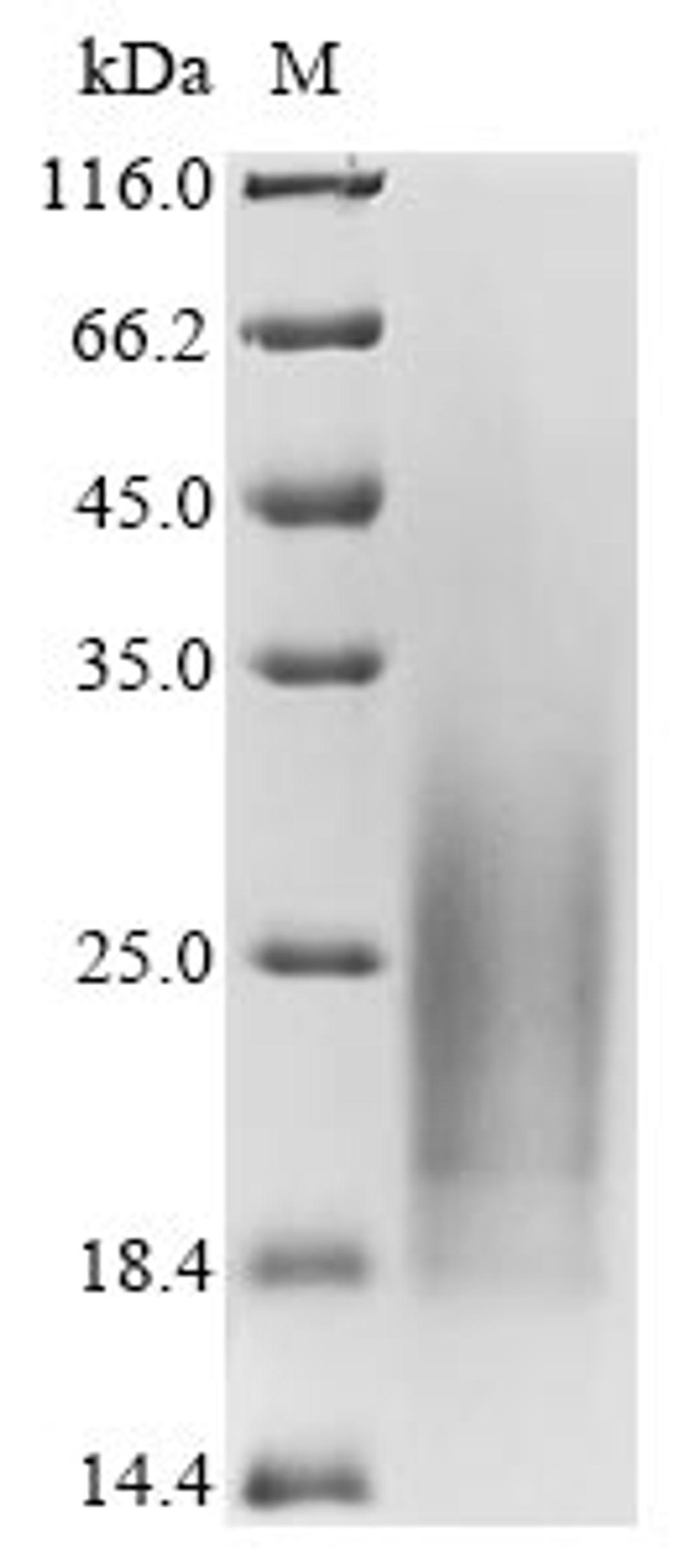 (Tris-Glycine gel) Discontinuous SDS-PAGE (reduced) with 5% enrichment gel and 15% separation gel.