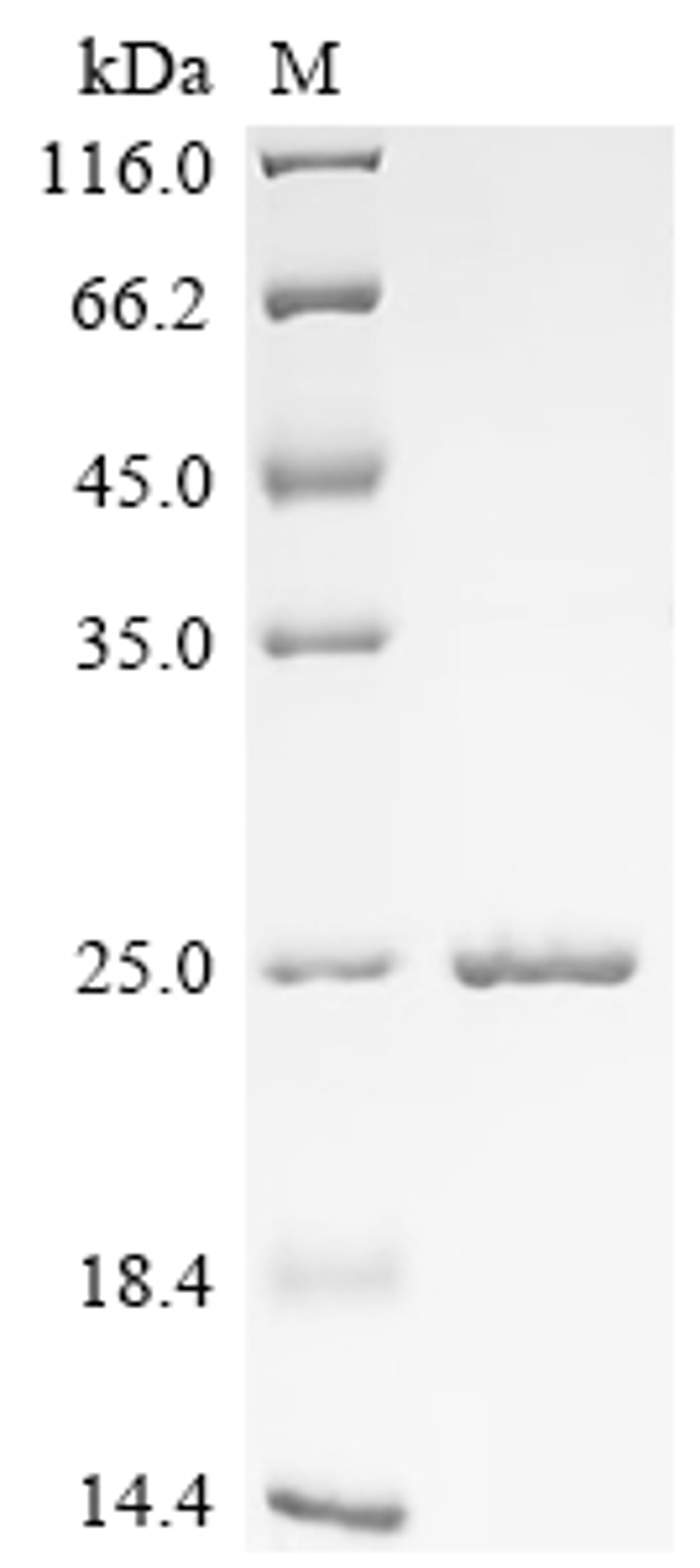 (Tris-Glycine gel) Discontinuous SDS-PAGE (reduced) with 5% enrichment gel and 15% separation gel.
