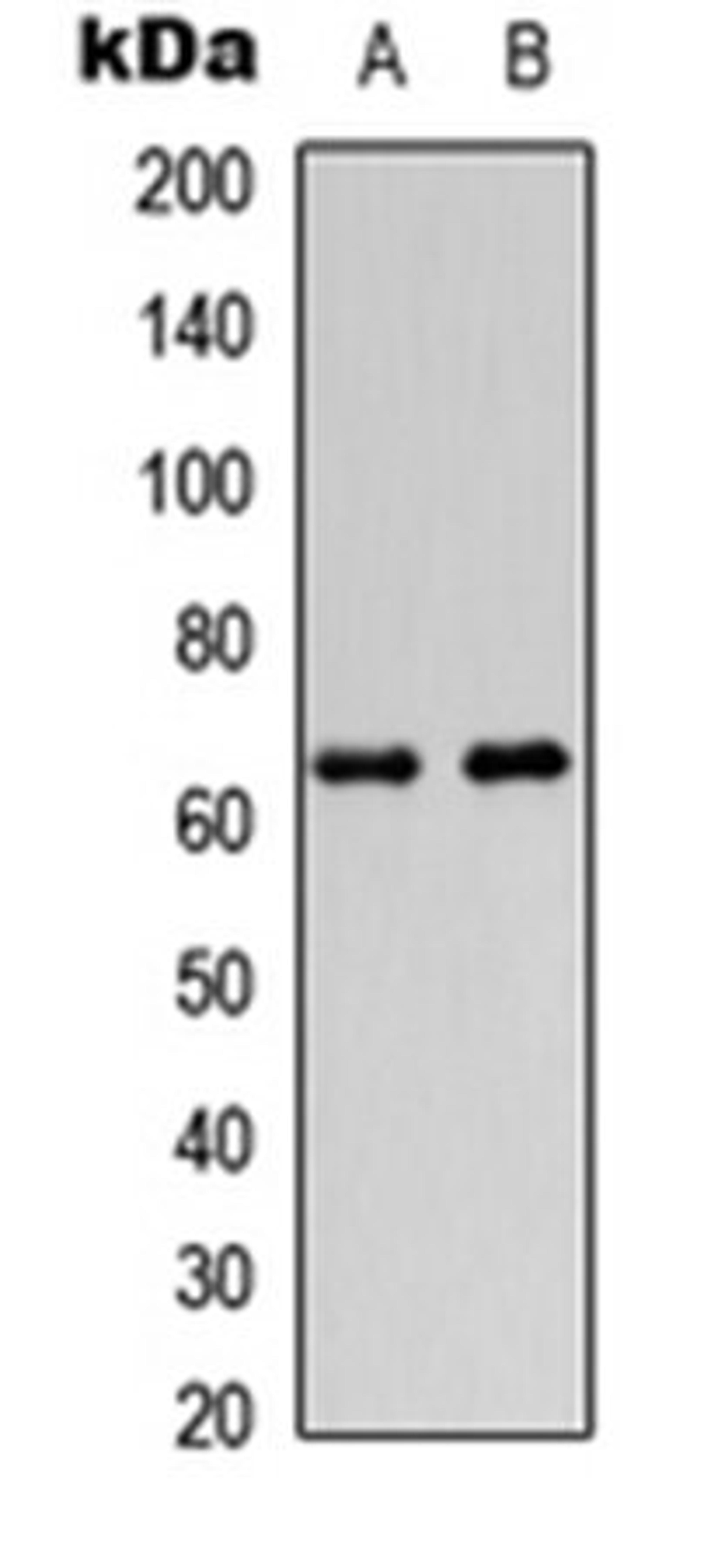 Western blot analysis of HeLa (Lane1), HEK293T (Lane2) whole cell using DGK epsilon antibody