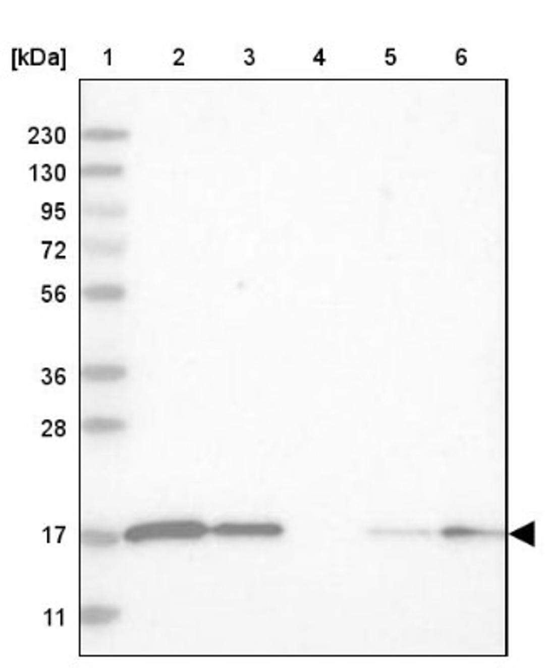 Western Blot: CNTF Antibody [NBP1-83277] - Lane 1: Marker [kDa] 230, 130, 95, 72, 56, 36, 28, 17, 11<br/>Lane 2: Human cell line RT-4<br/>Lane 3: Human cell line U-251MG sp<br/>Lane 4: Human plasma (IgG/HSA depleted)<br/>Lane 5: Human liver tissue<br/>Lane 6: Human tonsil tissue