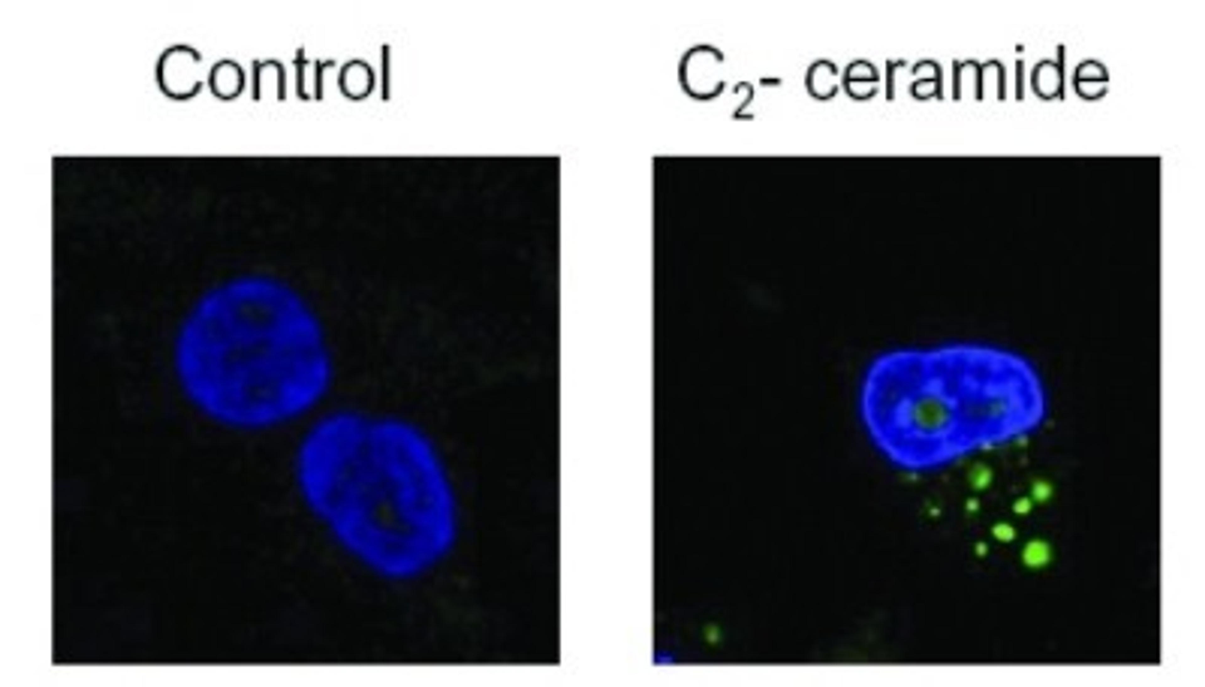 Immunocytochemistry/Immunofluorescence: LC3B/MAP1LC3B Antibody [NB600-1384] - Analysis using the HRP conjugate of NB600-1384. Staining of treated U373-MG cells using NB600-1384. The nuclei were stained with DAPI.