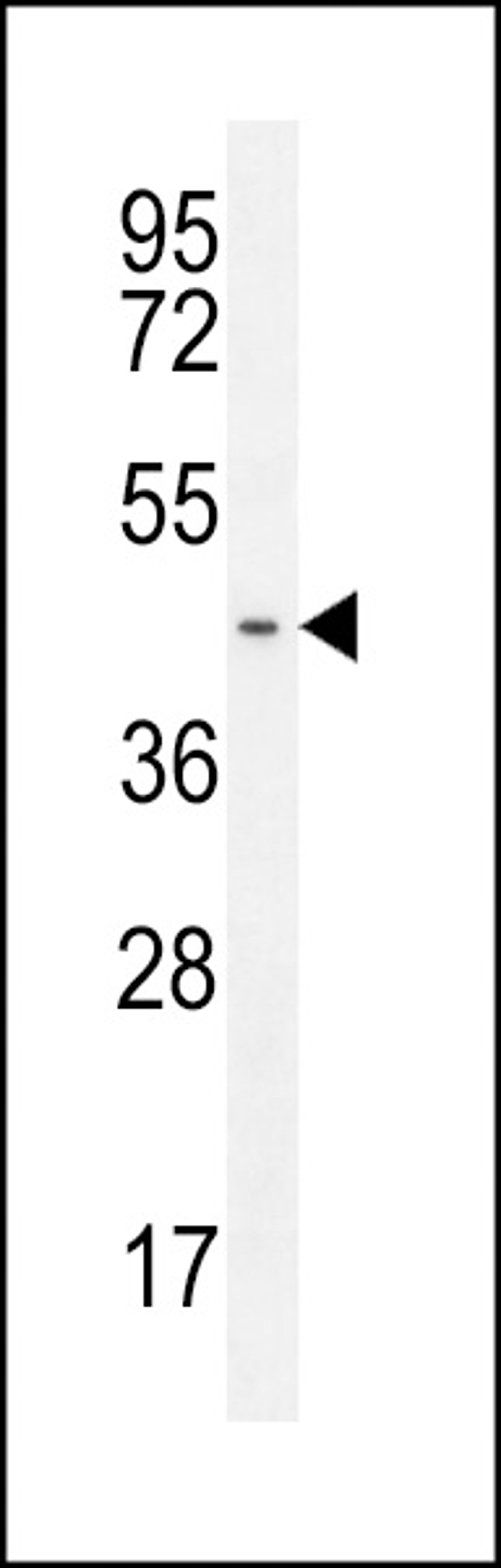 Western blot analysis in HL-60 cell line lysates (35ug/lane).