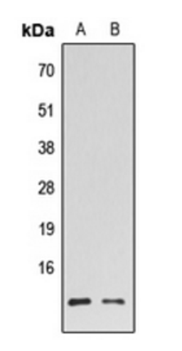 Western blot analysis of HL60 (Lane 1), K562 (Lane 2) whole cell lysates using HMGN2 antibody