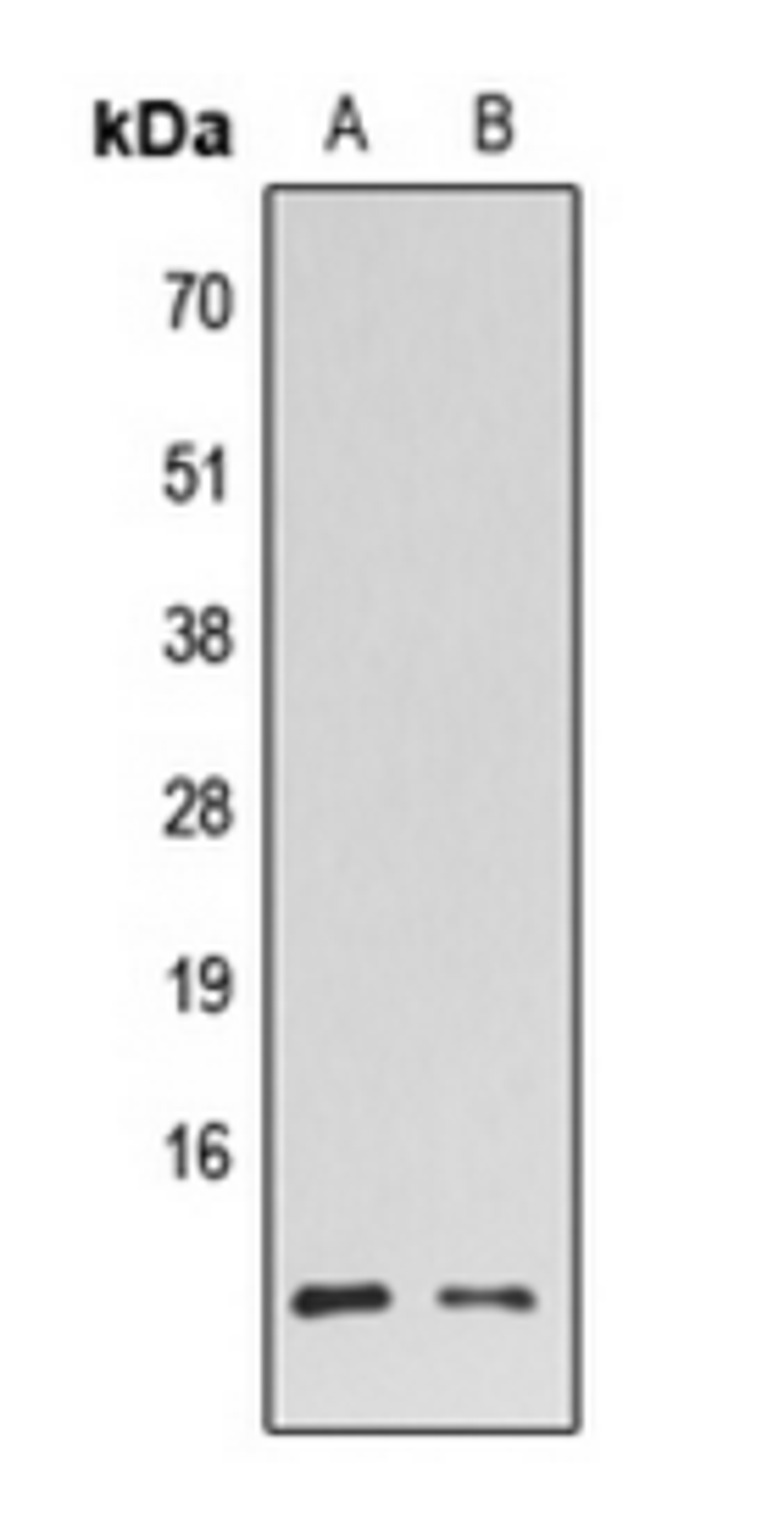 Western blot analysis of HL60 (Lane 1), K562 (Lane 2) whole cell lysates using HMGN2 antibody