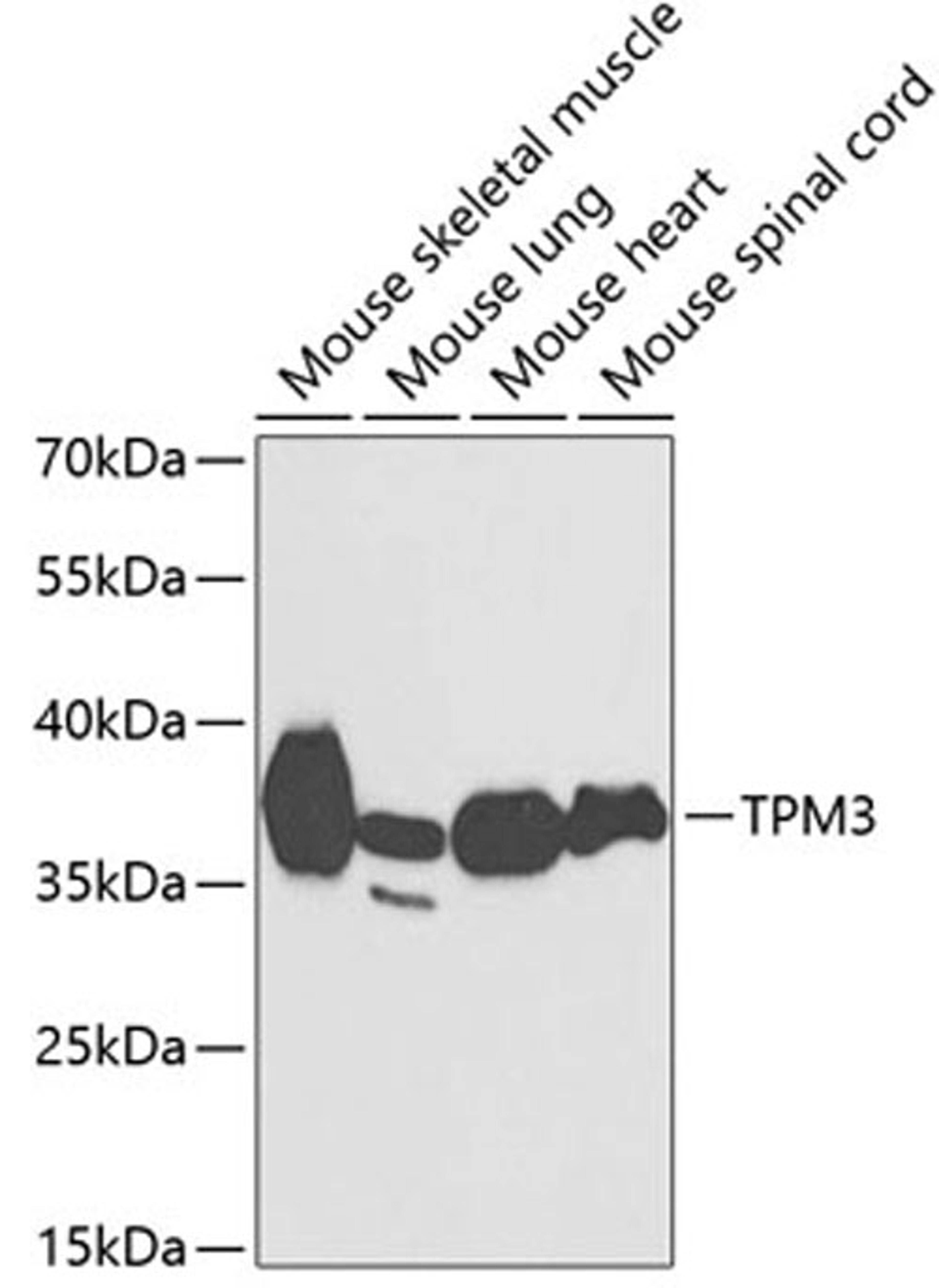 Western blot - TPM3 antibody (A13557)