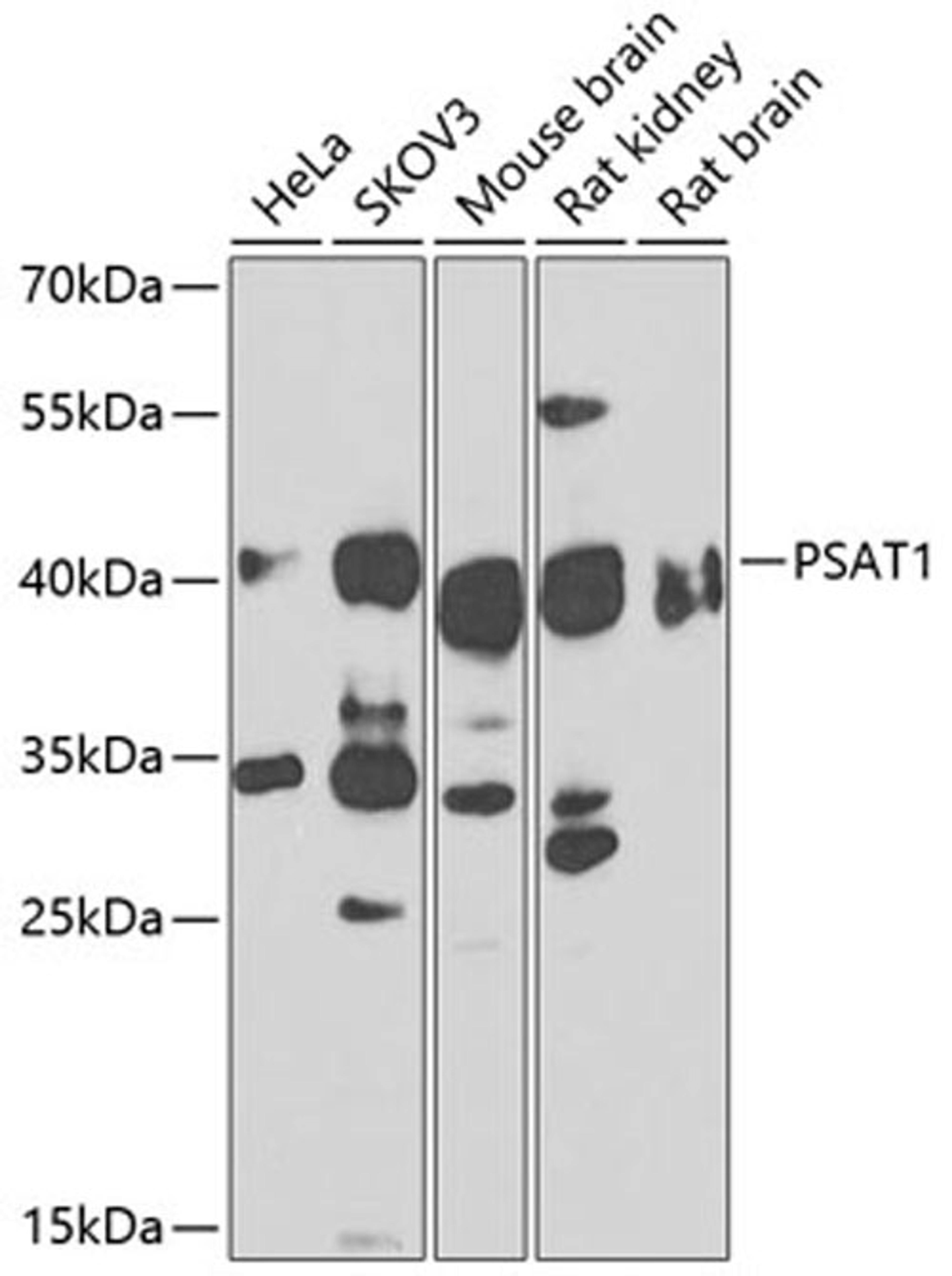 Western blot - PSAT1 antibody (A14124)