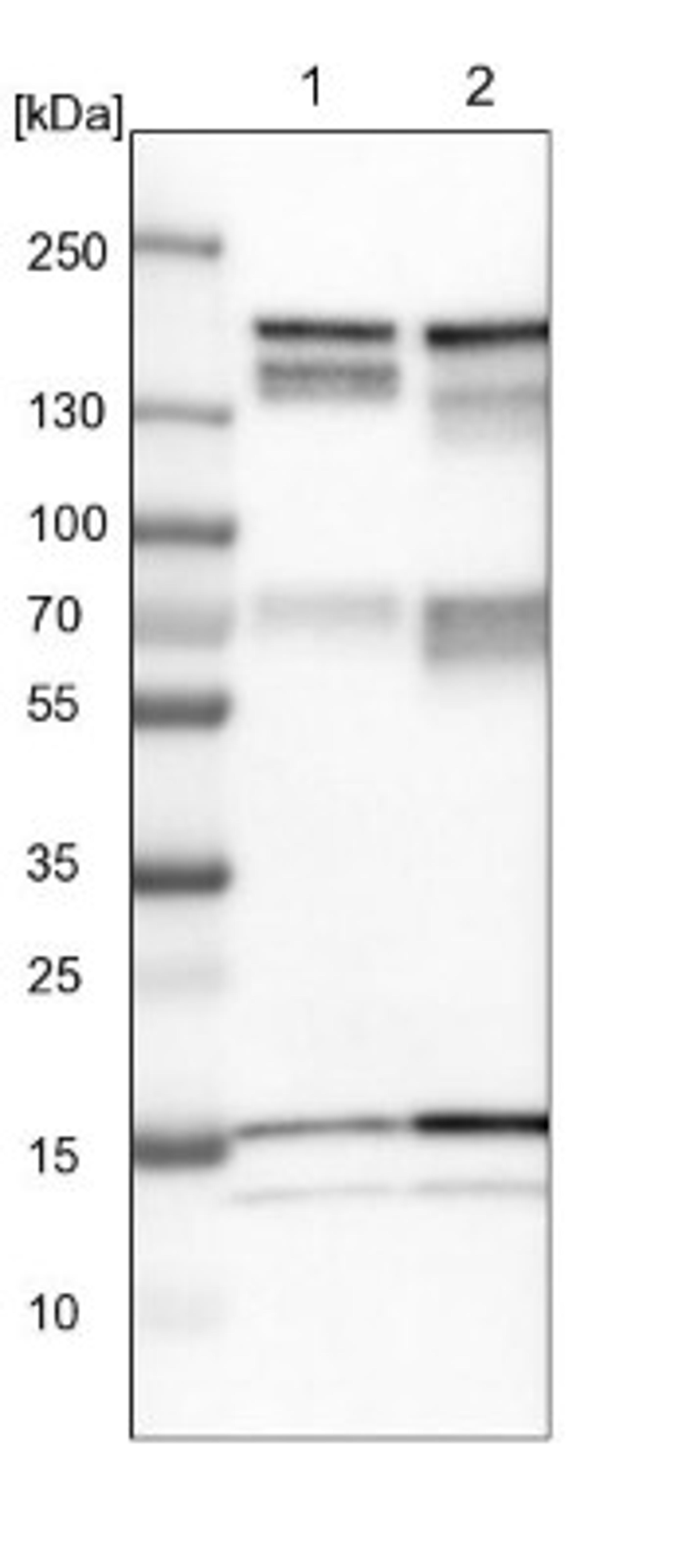 Western Blot: Tight Junction Protein 2 Antibody [NBP1-86850] - Lane 1: NIH-3T3 cell lysate (Mouse embryonic fibroblast cells)<br/>Lane 2: NBT-II cell lysate (Rat Wistar bladder tumour cells)