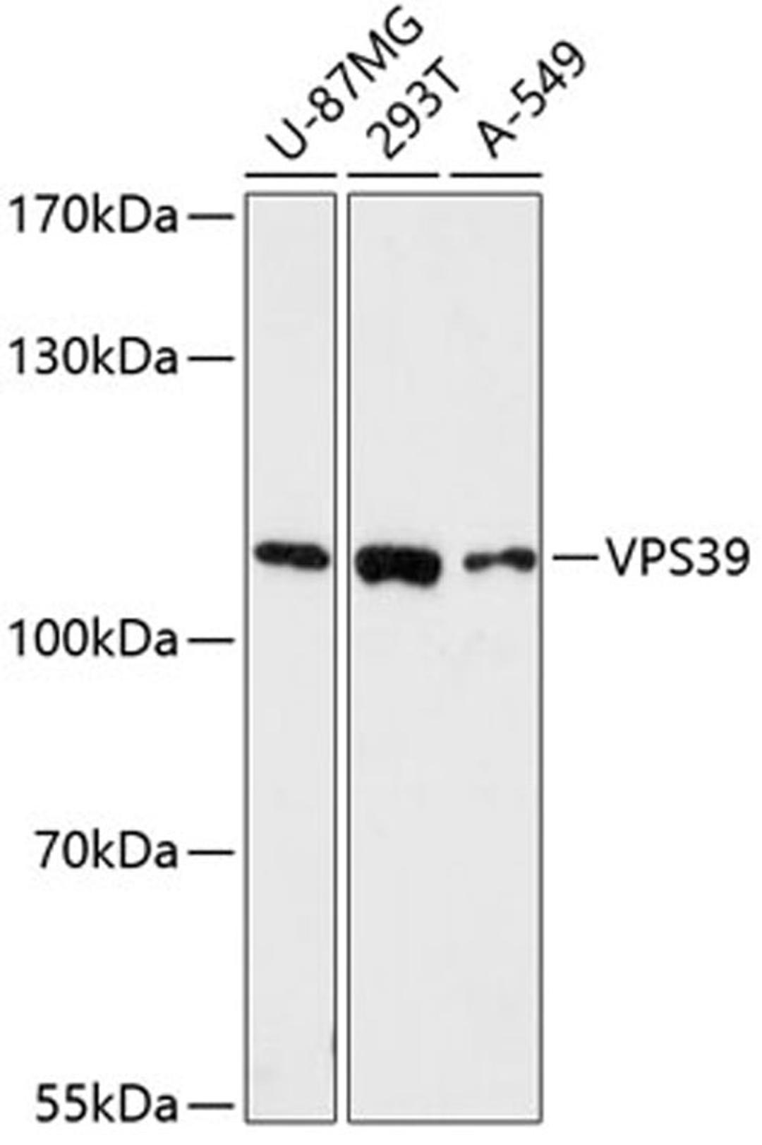 Western blot - VPS39 antibody (A13082)