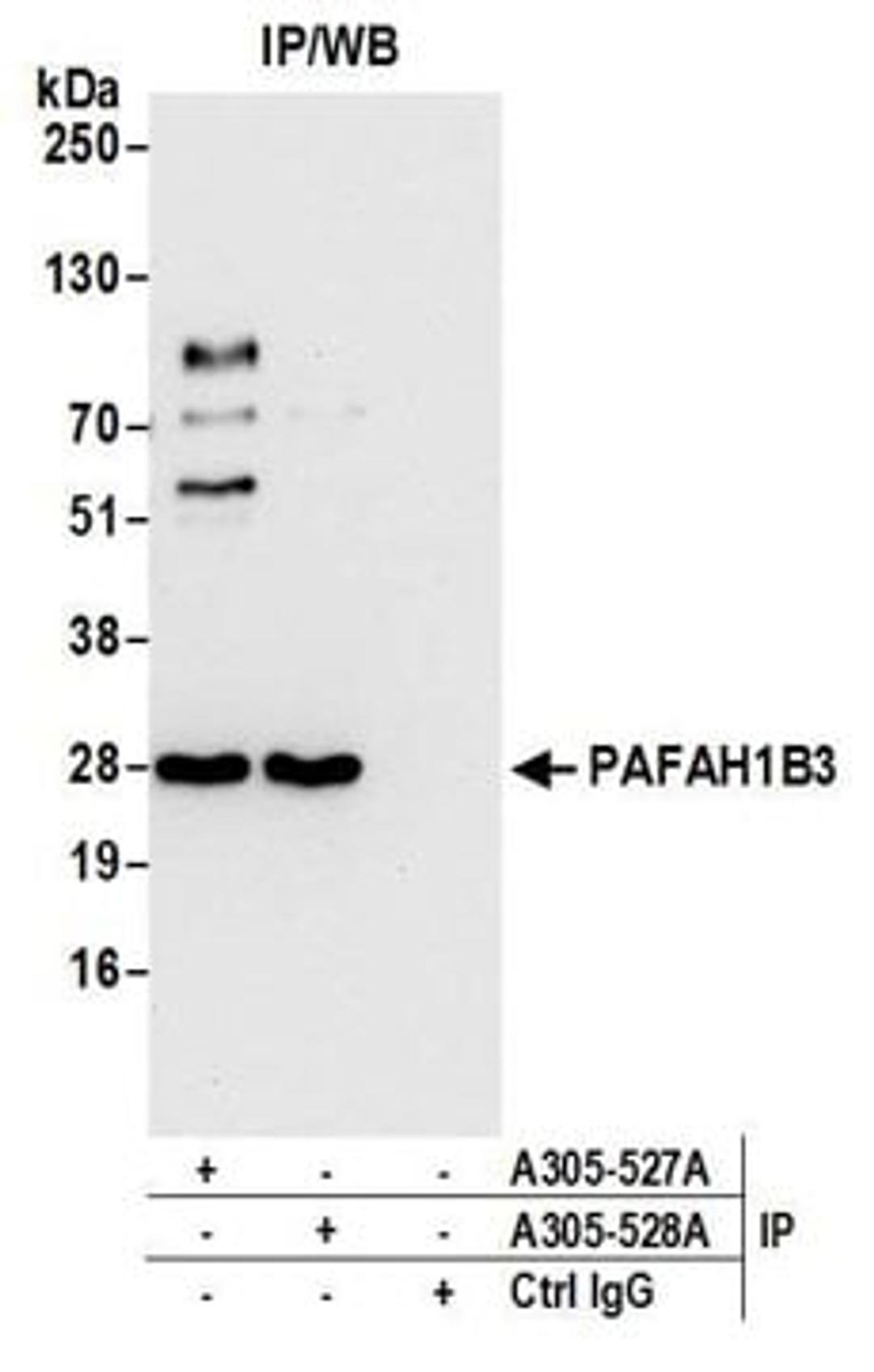 Detection of human PAFAH1B3 by western blot of immunoprecipitates.