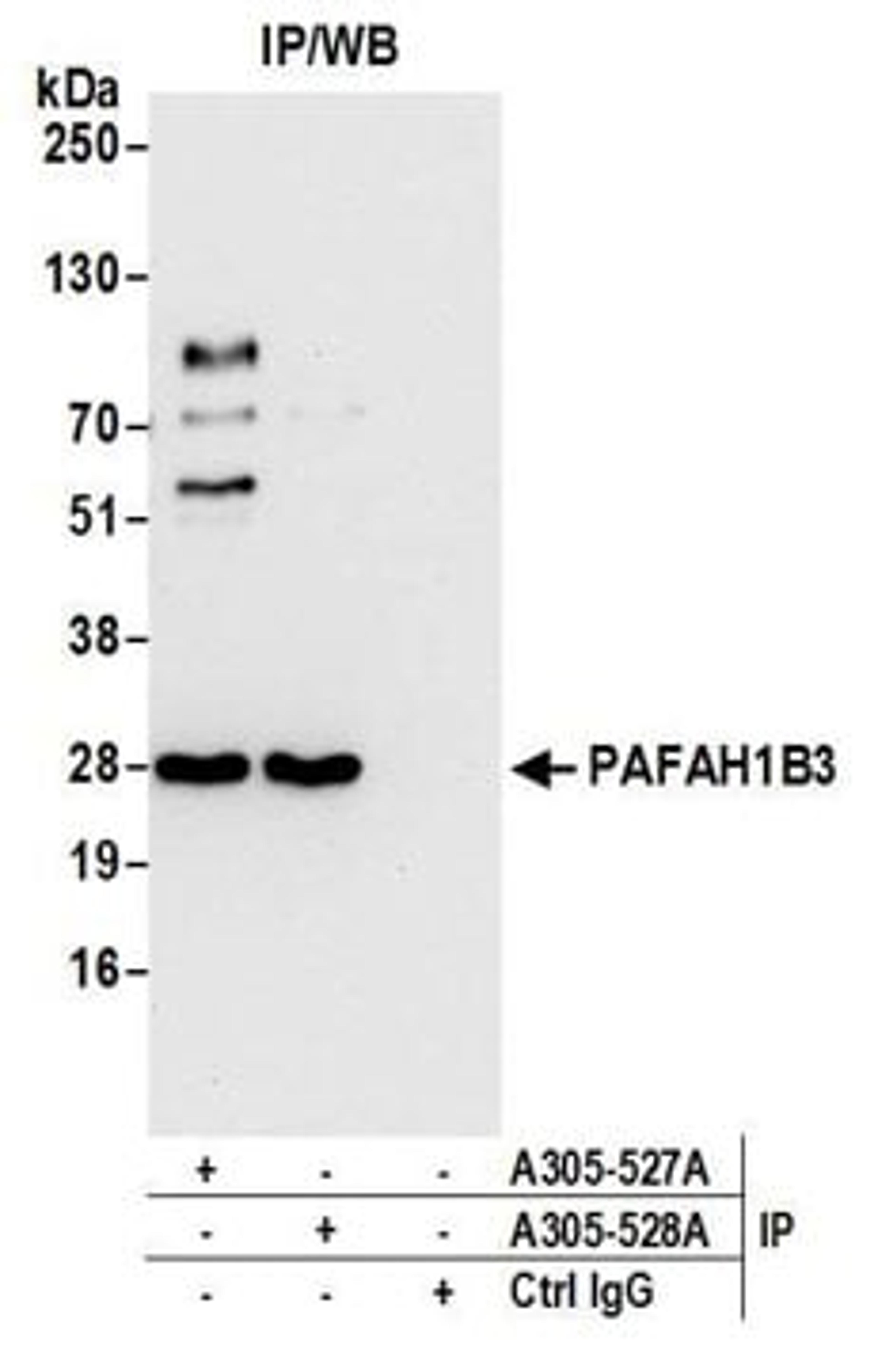 Detection of human PAFAH1B3 by western blot of immunoprecipitates.