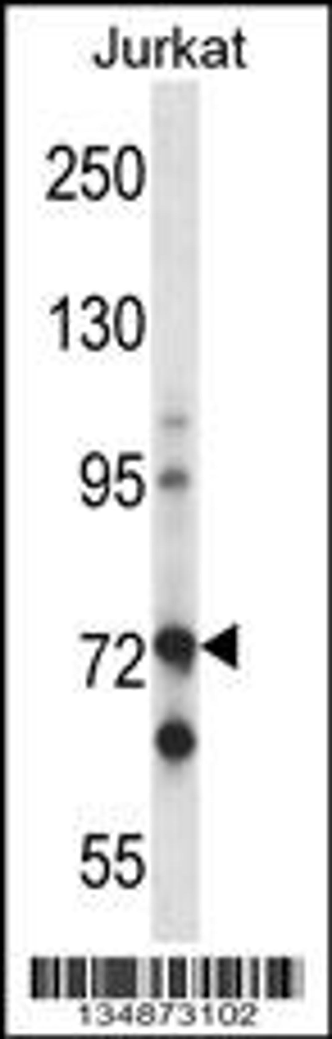 Western blot analysis in Jurkat cell line lysates (35ug/lane).