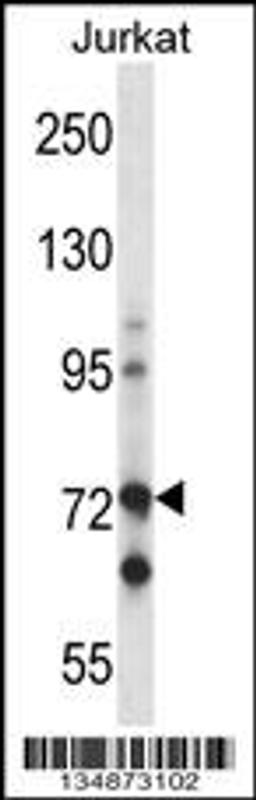 Western blot analysis in Jurkat cell line lysates (35ug/lane).