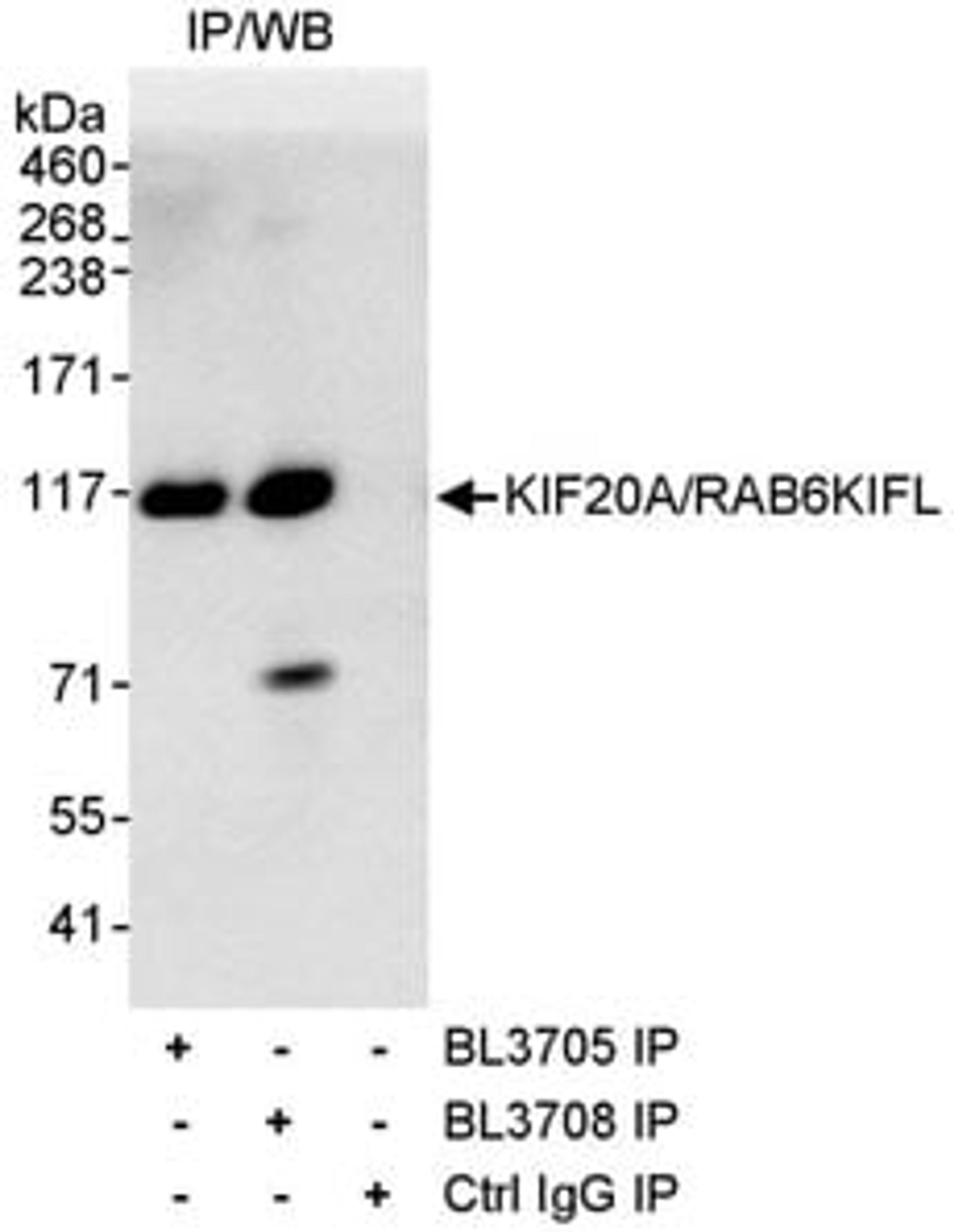 Detection of human KIF20A/RAB6KIFL by western blot of immunoprecipitates.