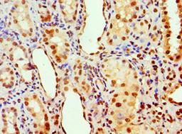Immunohistochemistry of paraffin-embedded human kidney tissue using CSB-PA001822ESR2HU at dilution of 1:100