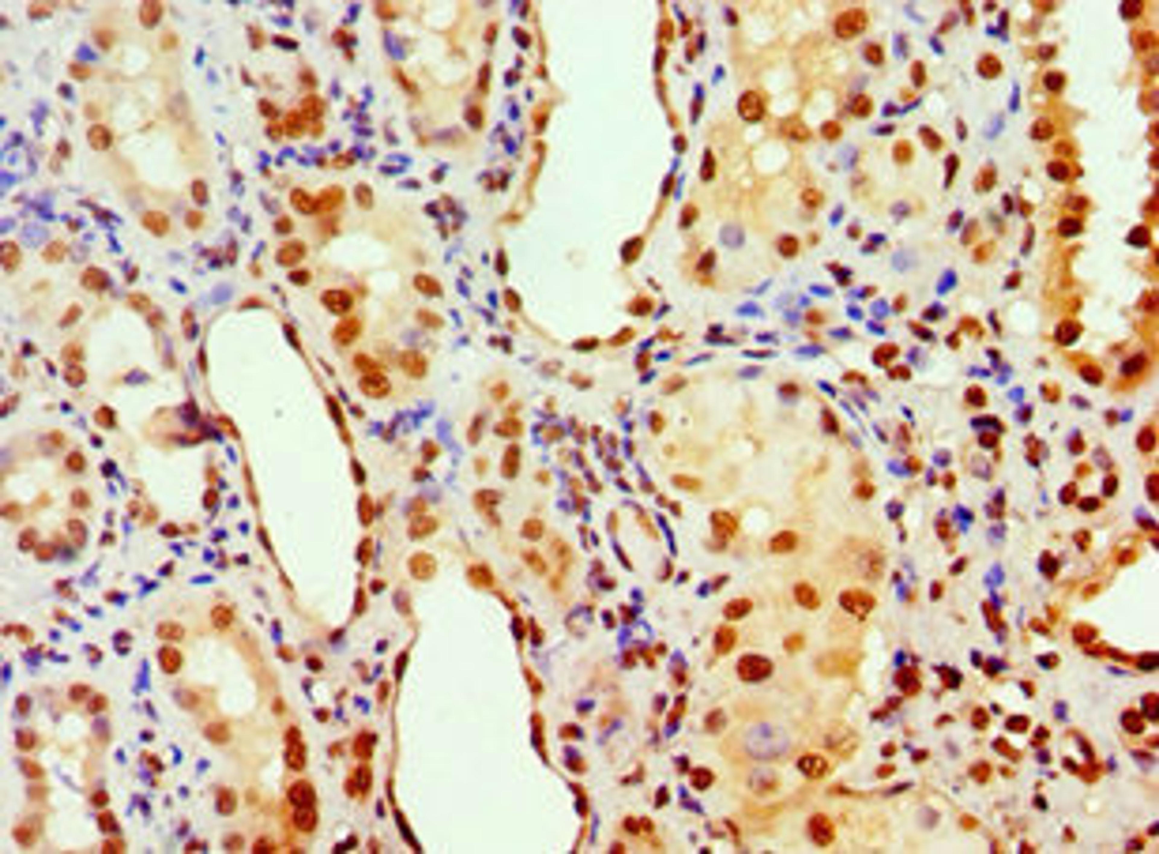 Immunohistochemistry of paraffin-embedded human kidney tissue using CSB-PA001822ESR2HU at dilution of 1:100
