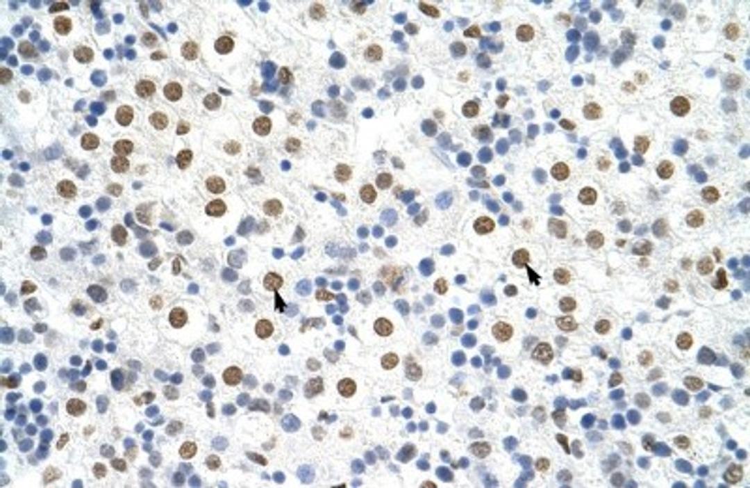 Immunohistochemistry: HNRPA3 Antibody [NBP1-80486] - Human Liver Cellular data: Hepatocytes Antibody Concentration: 4.0-8.0 ug/ml Magnification: 400X.