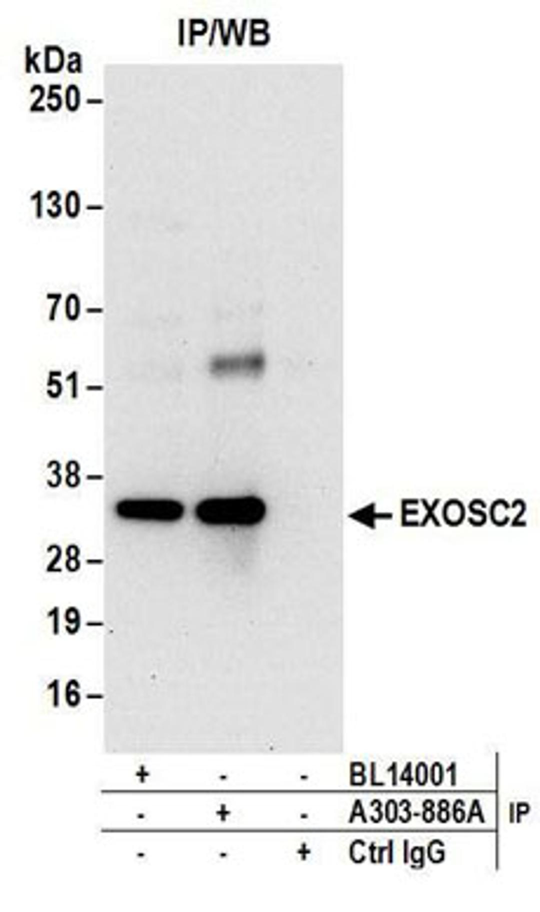 Detection of human EXOSC2 by western blot of immunoprecipitates.