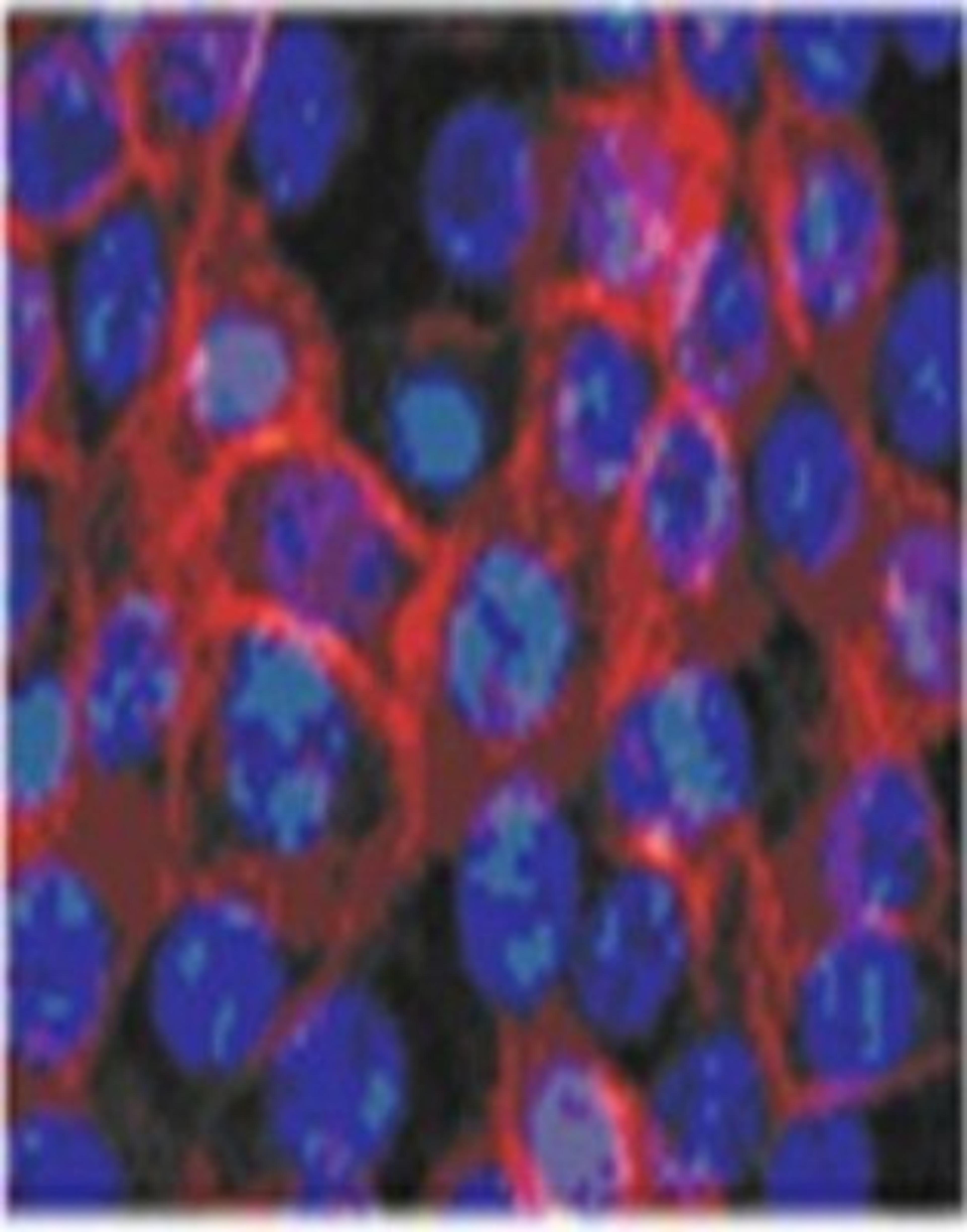 Immunocytochemistry/Immunofluorescence: Transglutaminase 1 Antibody [NB100-1844] - Epidermal keratinocytes from neonatal foreskin stained in immunofluorscene with Transglutaminase